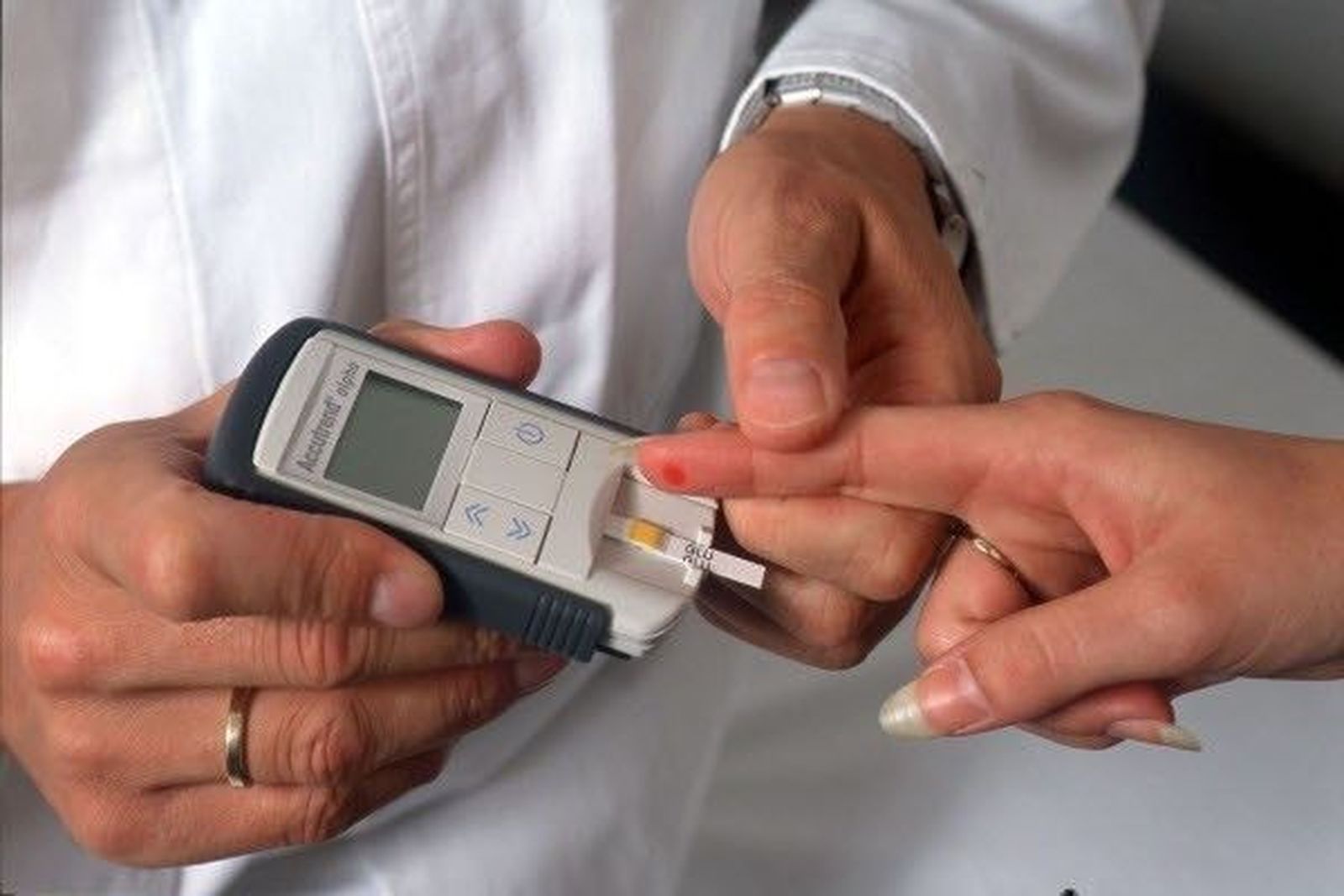 Diabetes. Foto de archivo.
