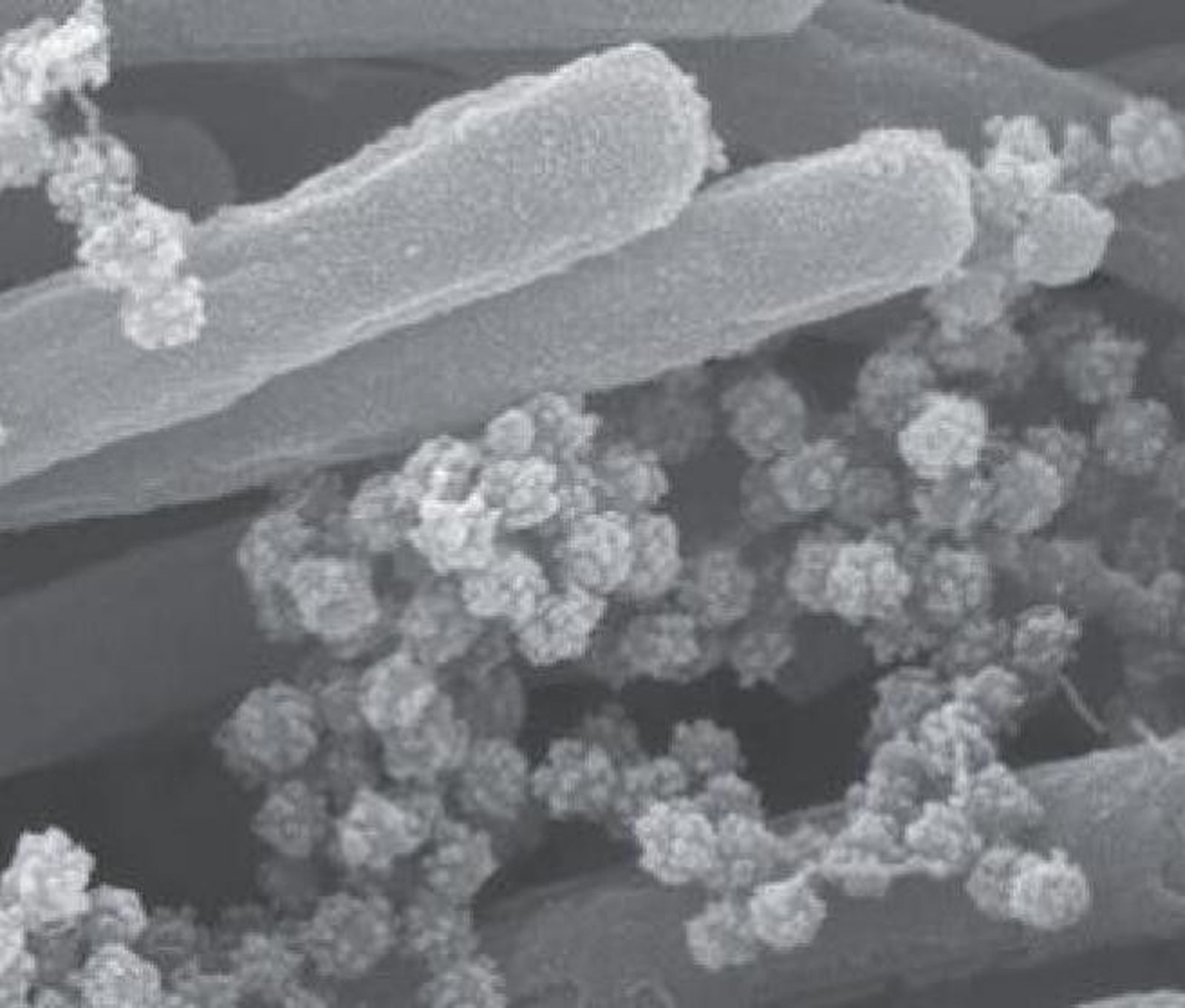 Coronavirus pulmones
