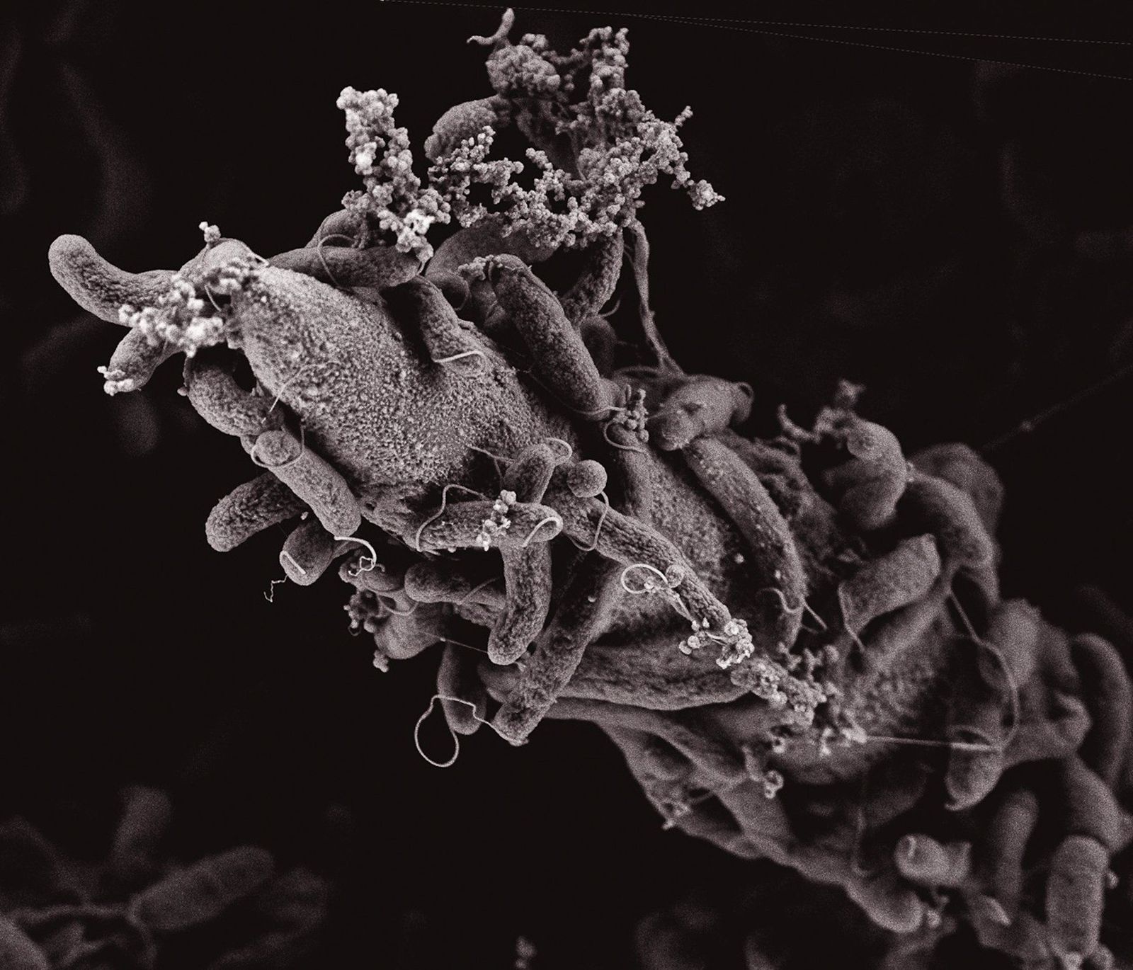 El cólera roba el ADN de otras bacterias para ser más virulento.