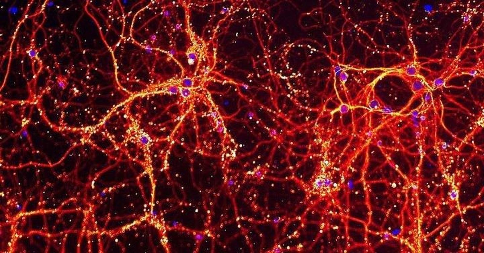 Esta imagen muestra las neuronas y sus conexiones entre sí en rojo | EP Esta imagen muestra las neuronas y sus conexiones entre sí en rojo | EP