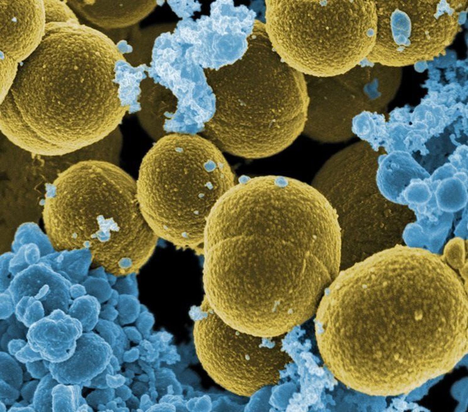 La importación ilegal de alimentos contribuye a propagar una peligrosa bacteria