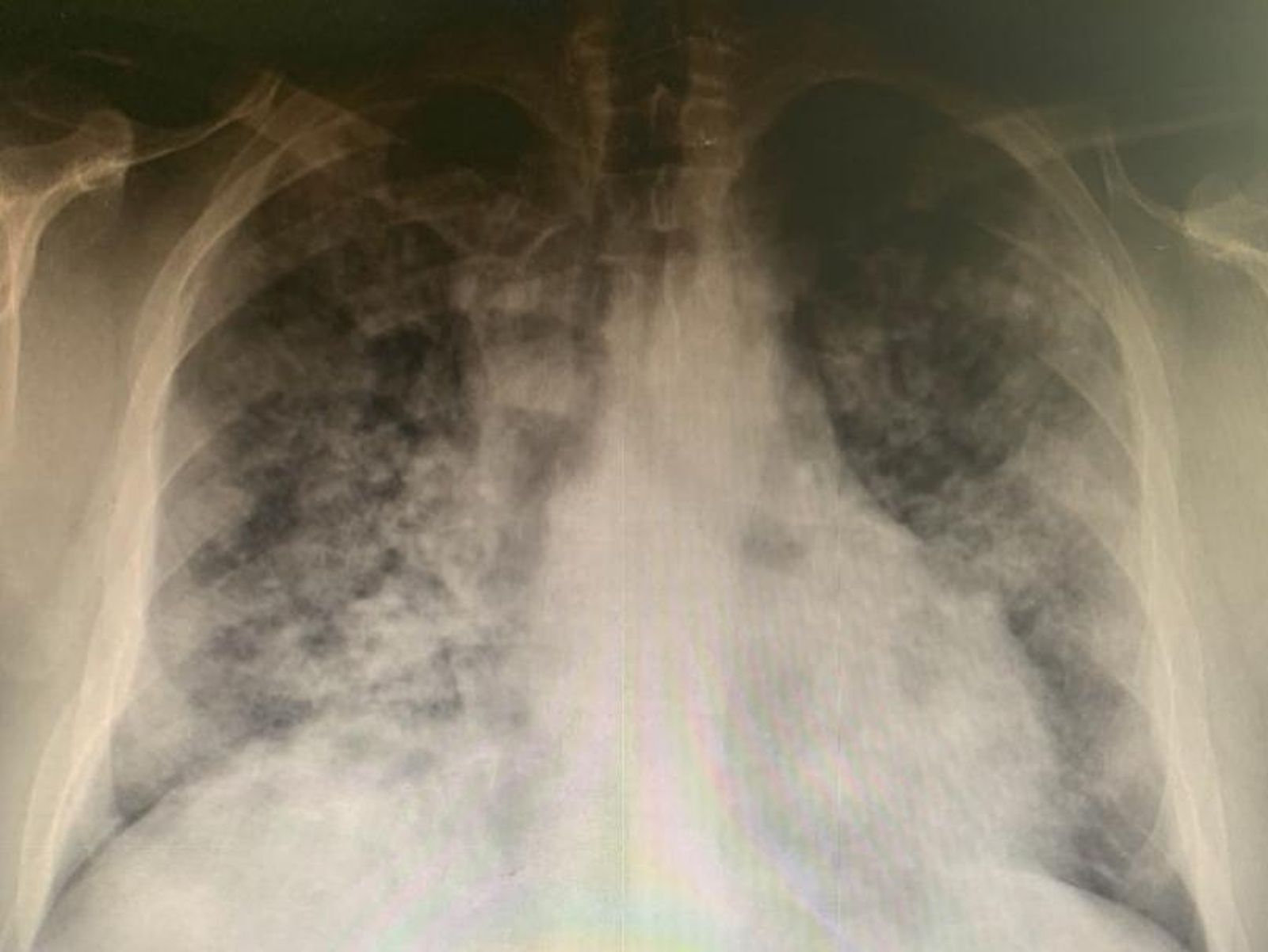 “El peor momento de la pandemia” para este médico de Urgencias de Salamanca se ha producido esta semana