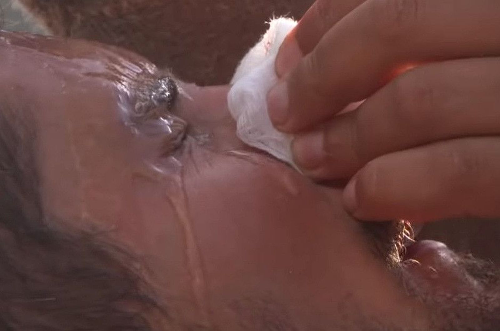 Nariz rota supervivientes