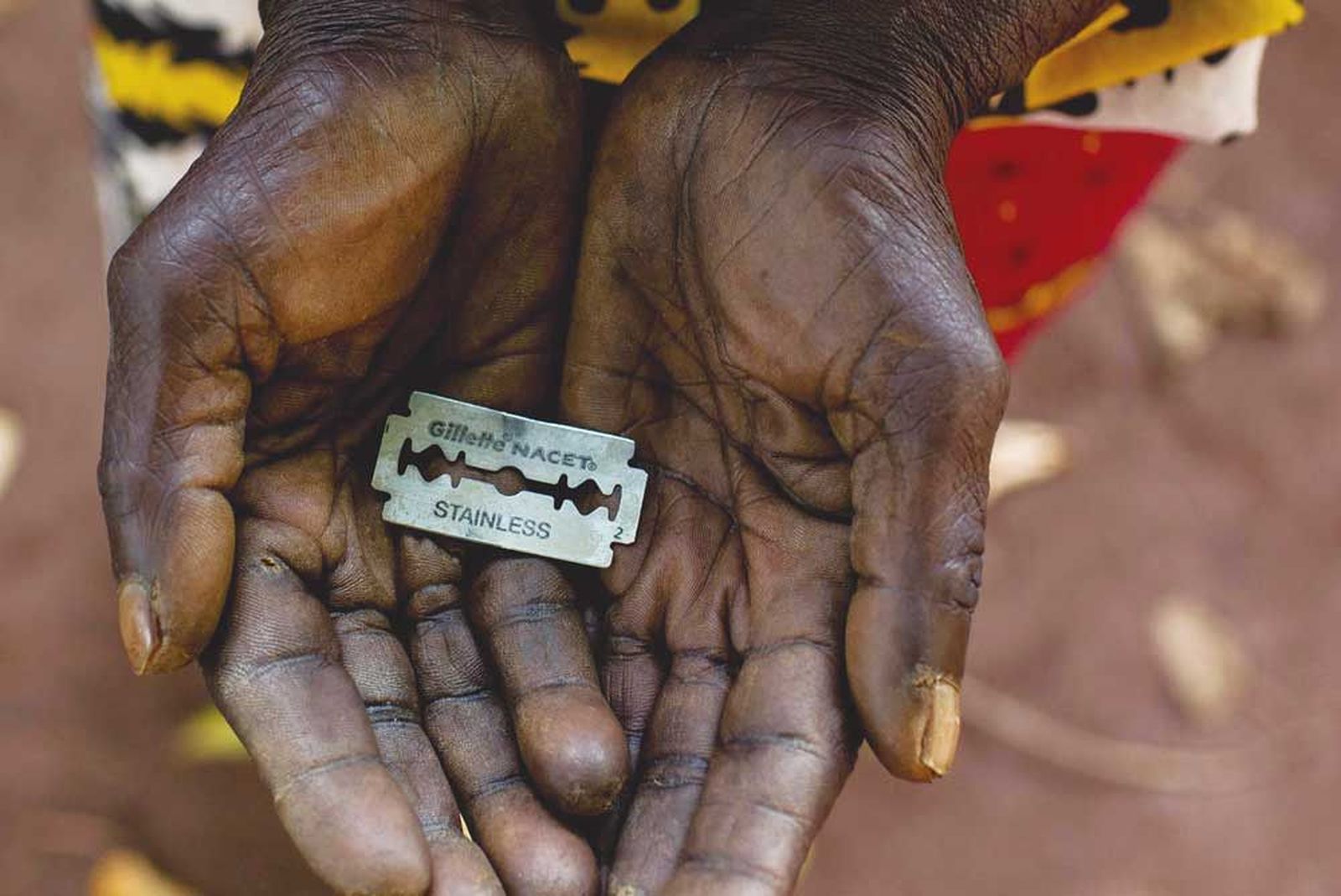 Ablacion manos y cuchullas