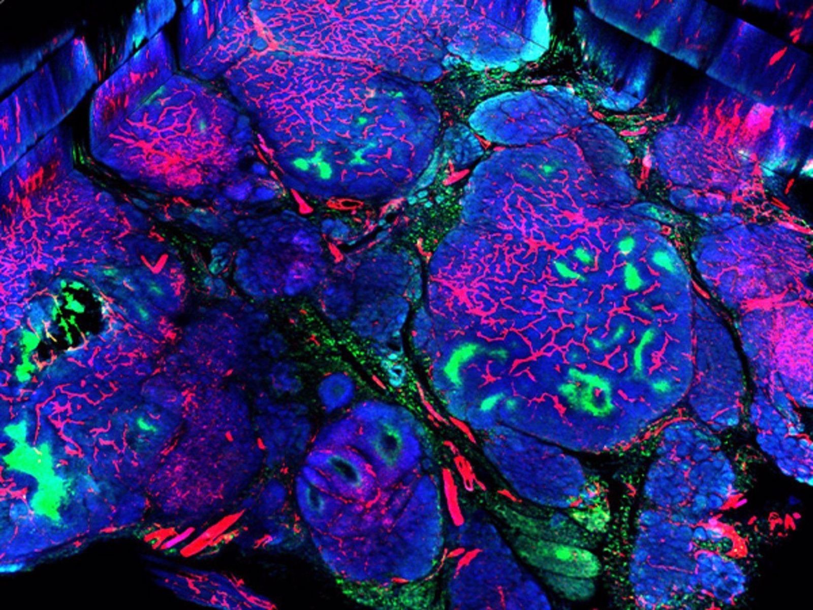 Mama con presencia de células cancerígenas | EUROPA PRESS