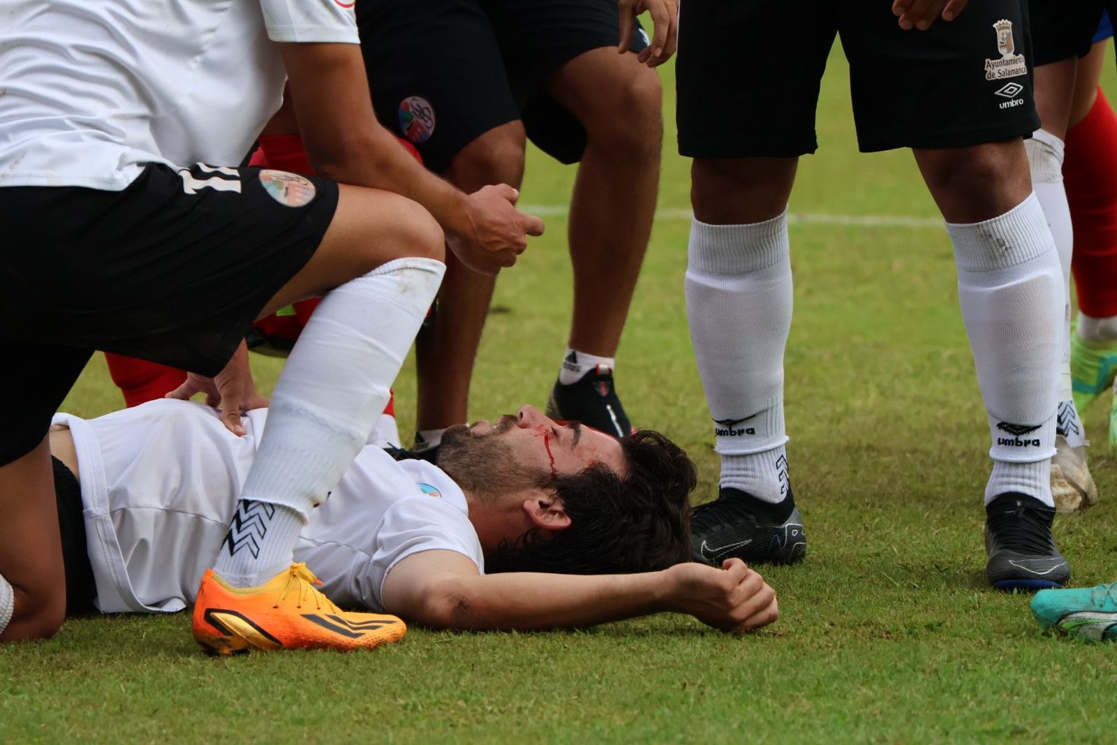 Javi Navas, tendido en el suelo y sangrando por un corte | FOTO ANDREA MATEOS