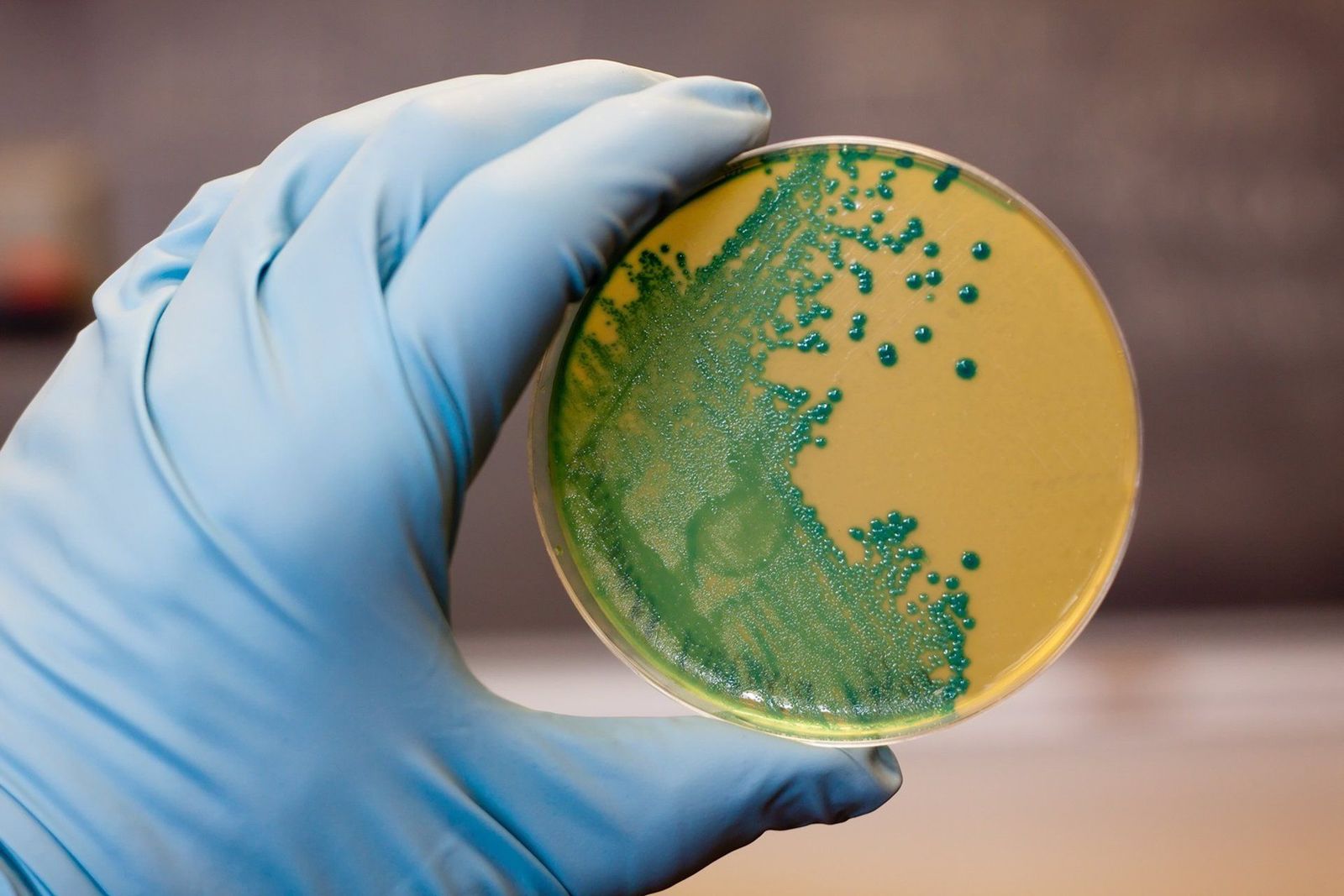 Listeria monocytogenes que crece en una placa de agar.   ENVATO.