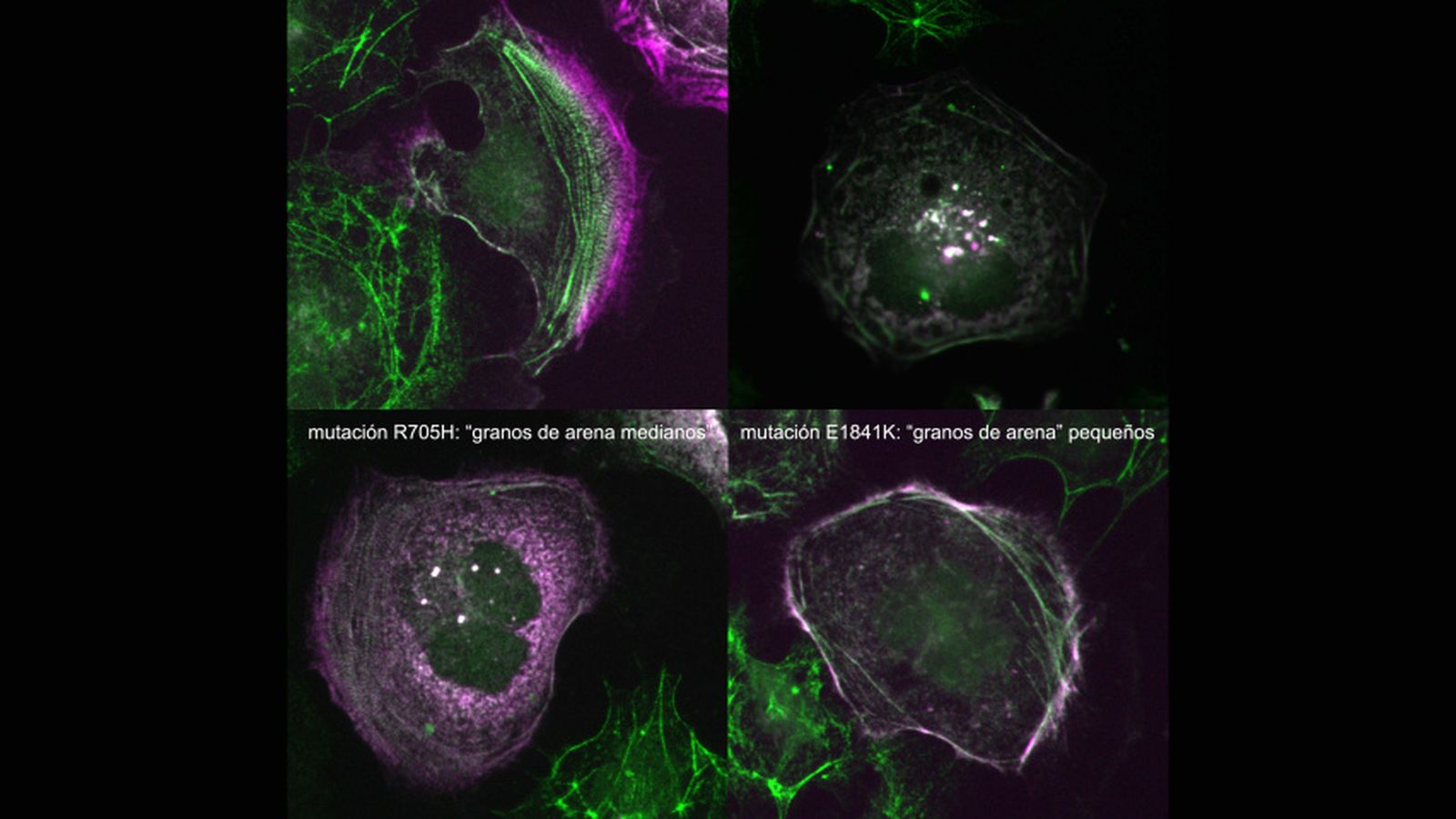 El CIC descubre cómo las mutaciones en el gen MYH9 dictan la gravedad de enfermedades raras de la sangre