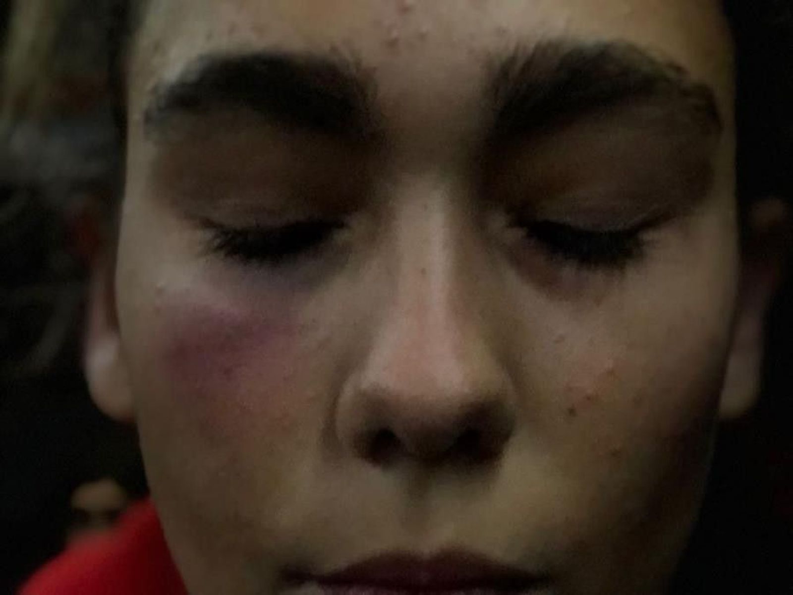 AITANALESIONPOMULOCopy