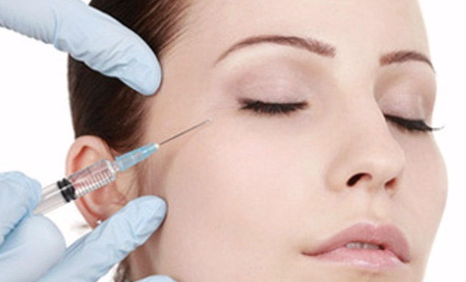 Bótox | Europa Press