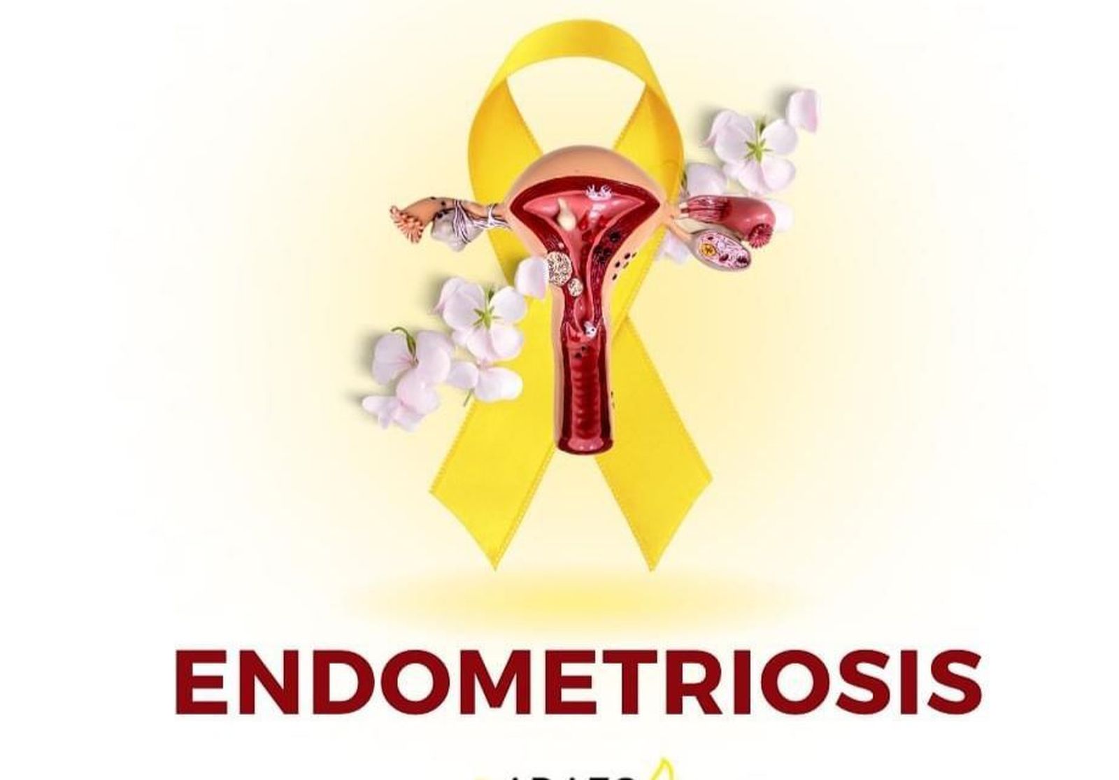 Endometriosis ADAEC.