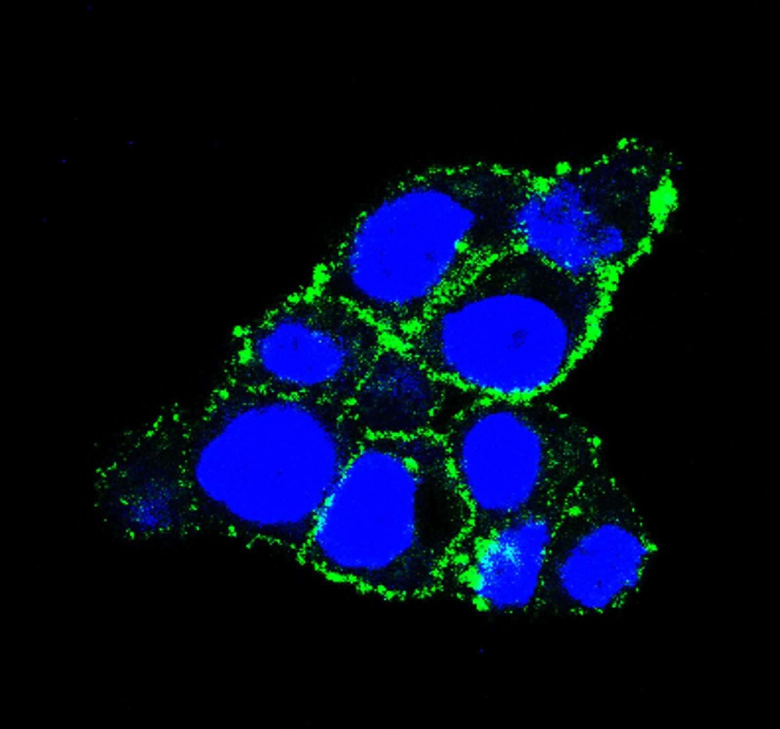 El Centro de Investigación del Cáncer (USAL-CSIC) lidera un estudio acerca de una nueva terapia dirigida contra el cáncer de páncreas El Centro de Investigación del Cáncer (USAL-CSIC) lidera un estudio acerca de una nueva terapia dirigida contra el cáncer de páncreas