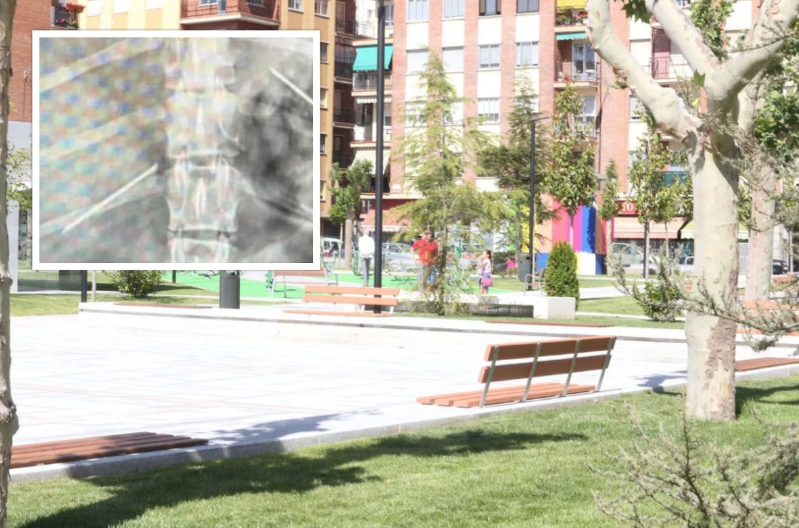 Parque de Garrido junto a la radiografía del perro dañado