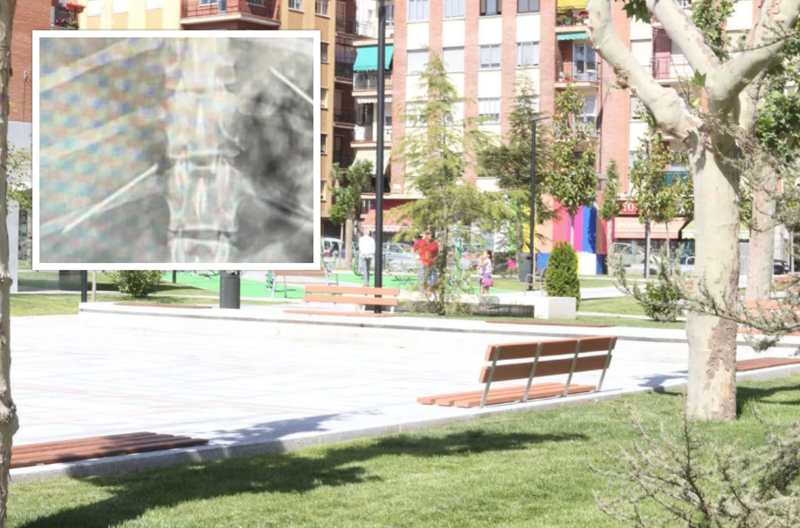 Parque de Garrido junto a la radiografía del perro dañado