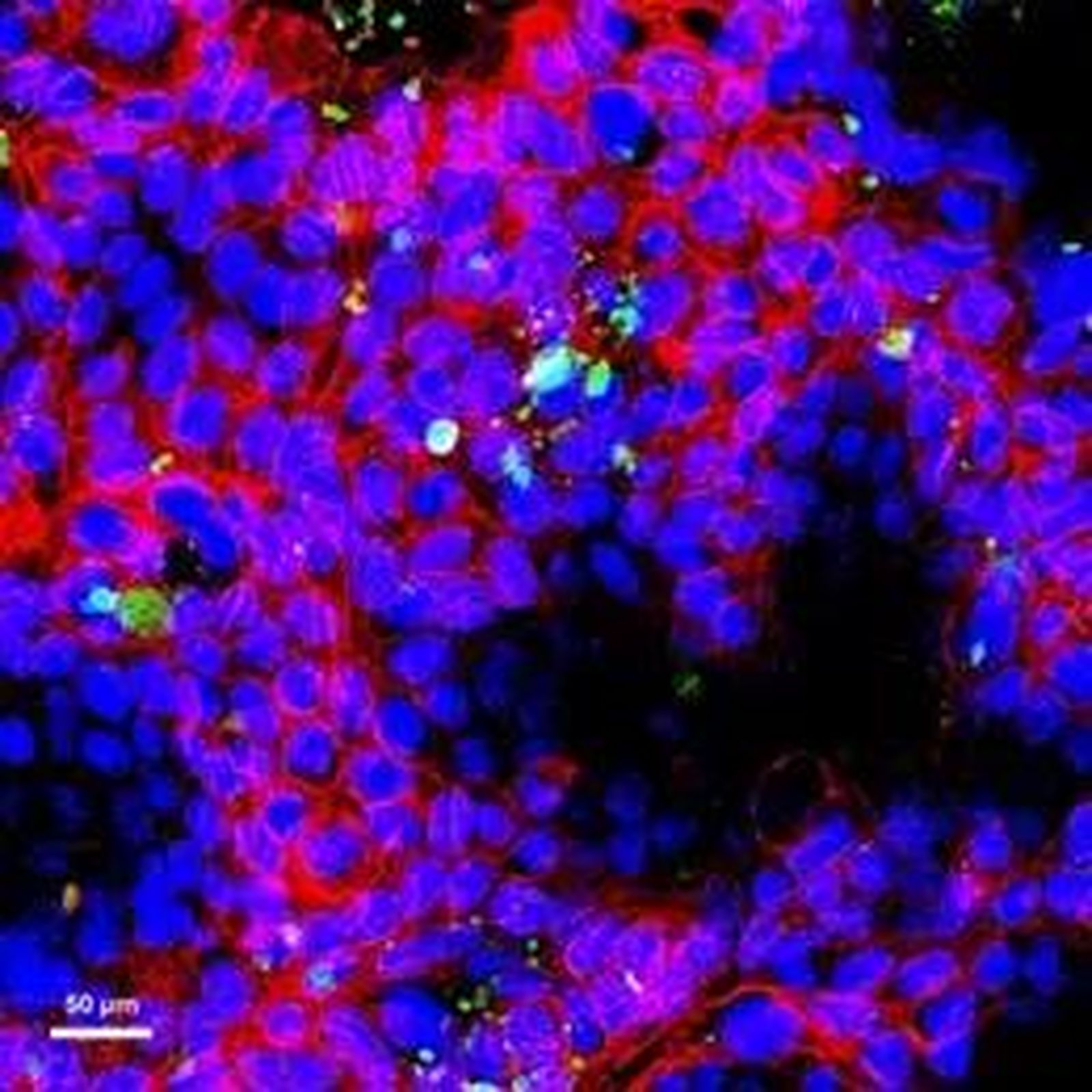 Las imágenes de microscopía muestran la capacidad de los nanoplásticos para interactuar con las células intestinales. Celular en azul y la membrana celular en rojo - UAB