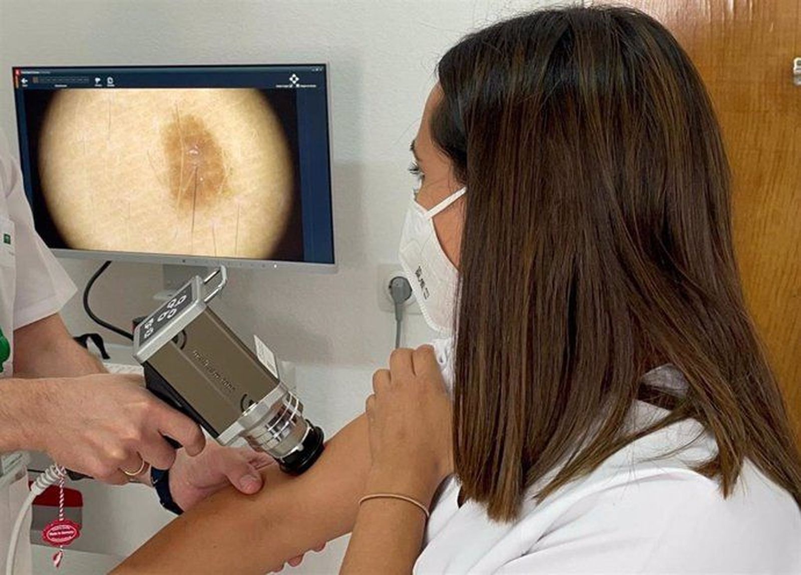 Prueba de cáncer de piel en una consulta-EP