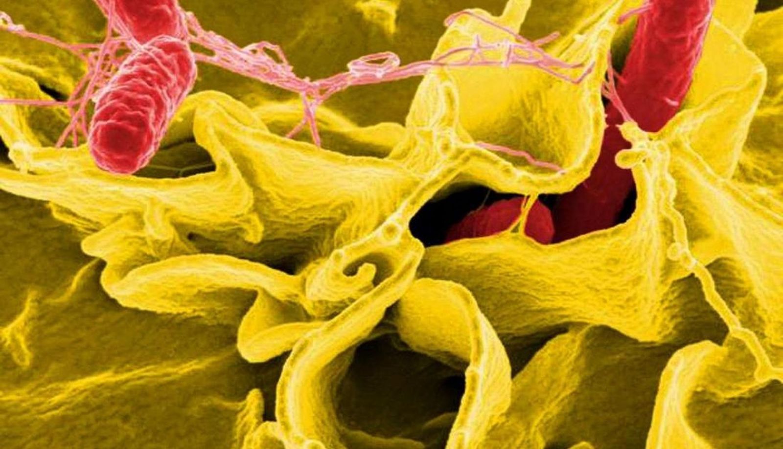  Bacteria salmonella, salmonela 