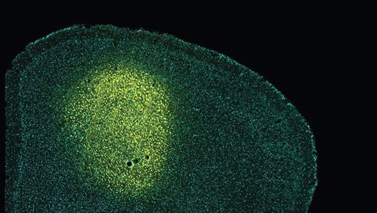 Modelos animales. EP