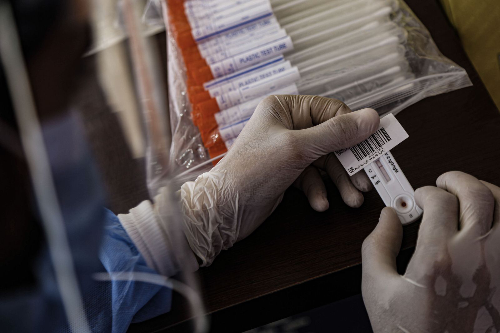 16 June 2020, Egypt, Cairo: A health worker holds swab samples collected from people at a drive-through coronavirus (COVID-19) testing unit inside the parking lot of Ain Shams University Specialized H 16 June 2020, Egypt, Cairo: A health worker holds swab samples collected from people at a drive-through coronavirus (COVID-19) testing unit inside the parking lot of Ain Shams University Specialized H