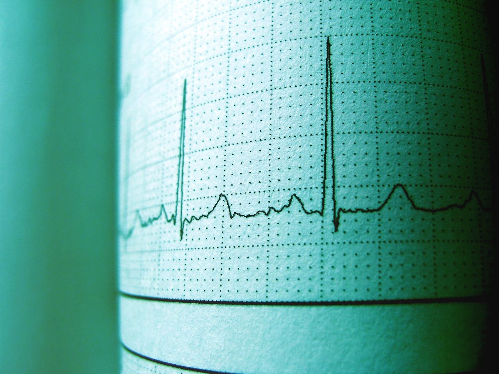 Imagen de un electrocardiograma Imagen de un electrocardiograma