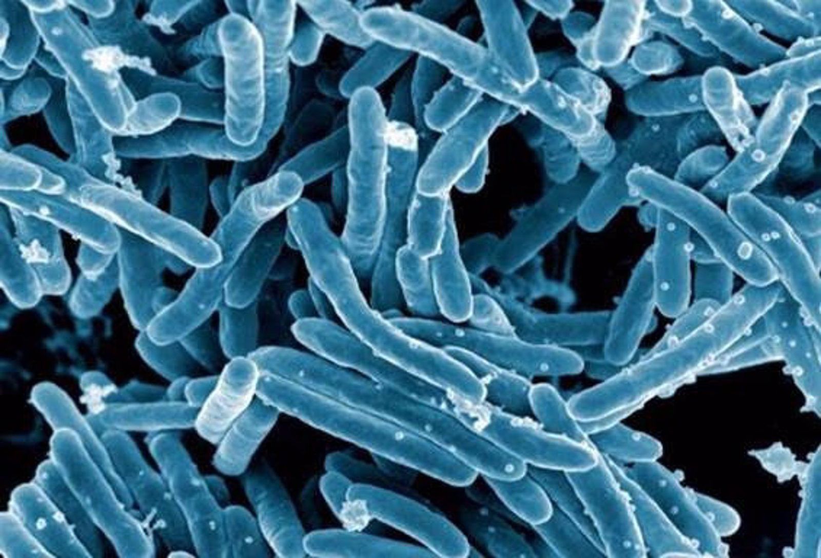 Imagen de microscopio de la bacteria Mycobacterium tuberculosis. EP