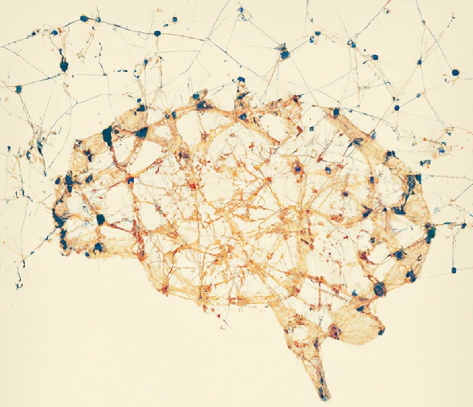 Archivo - Cerebro afectado por la esquizofrenia. - IVANA OLLÀ - Archivo