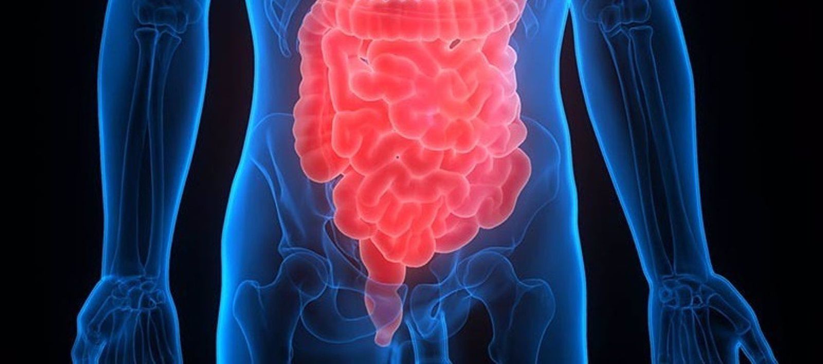 Intestino y colon EP