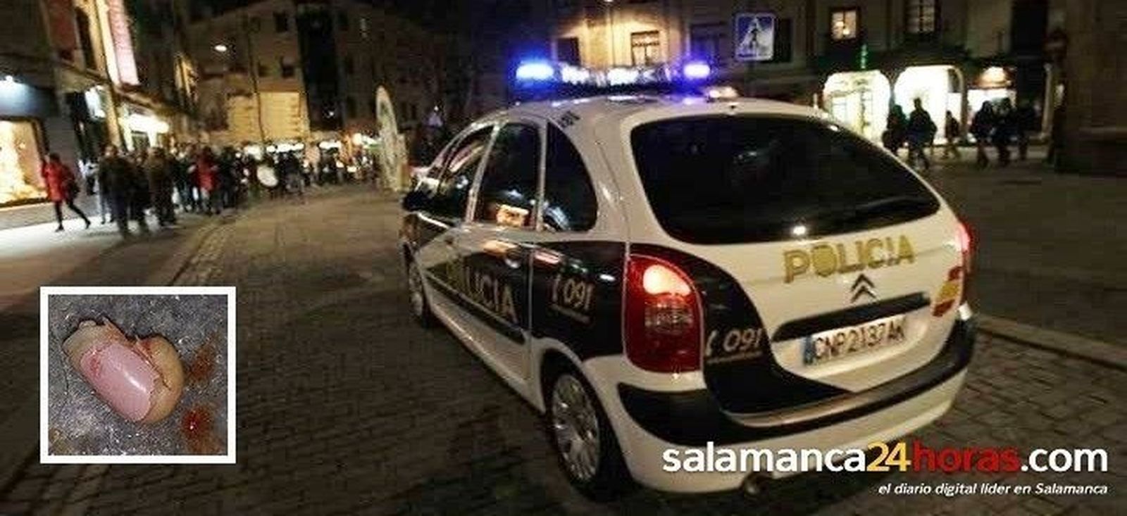 Una joven arranca la falange de un dedo a otra de un mordisco en la barra de un bar