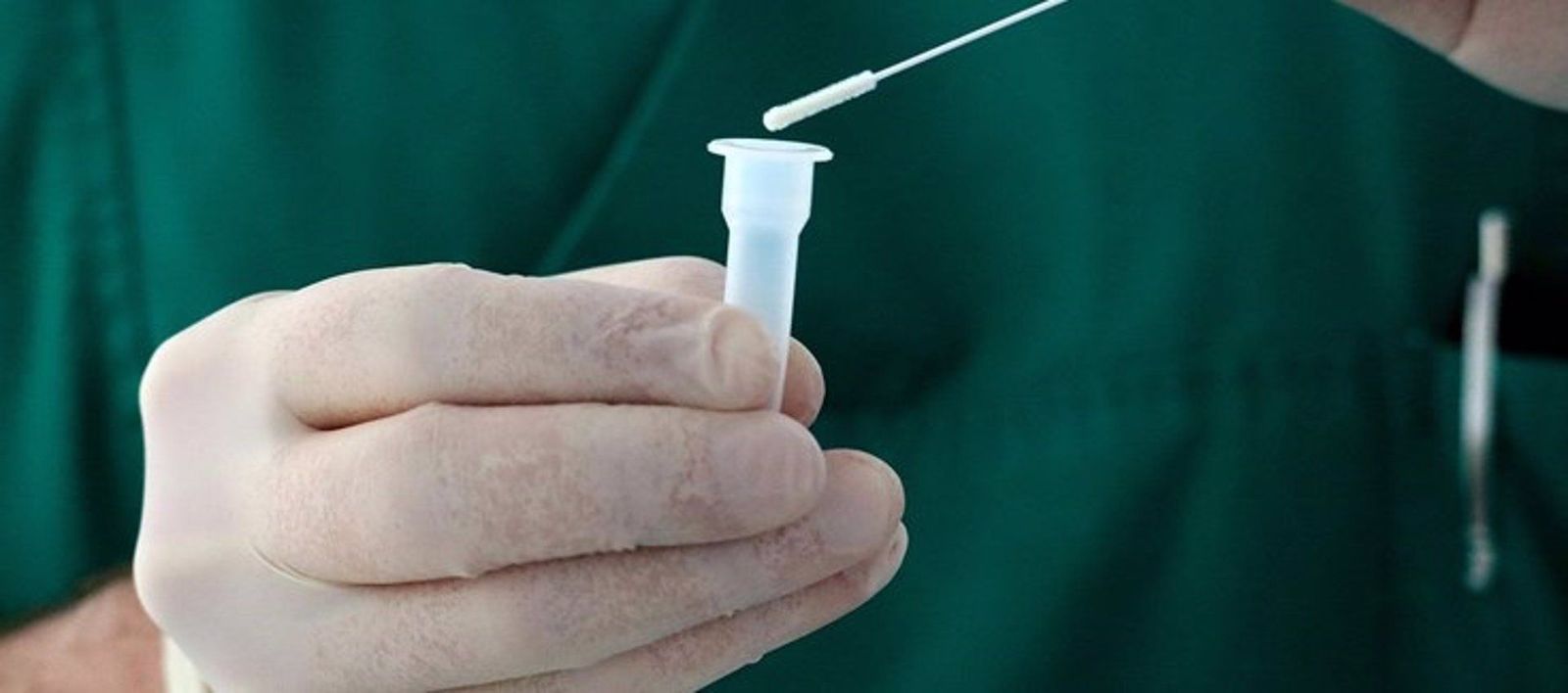 El estudio confirma que un porcentaje sustancial de pacientes infectados por SARS-CoV-2 puede tener resultados negativos en las pruebas serológicas en los meses posteriores a la infección