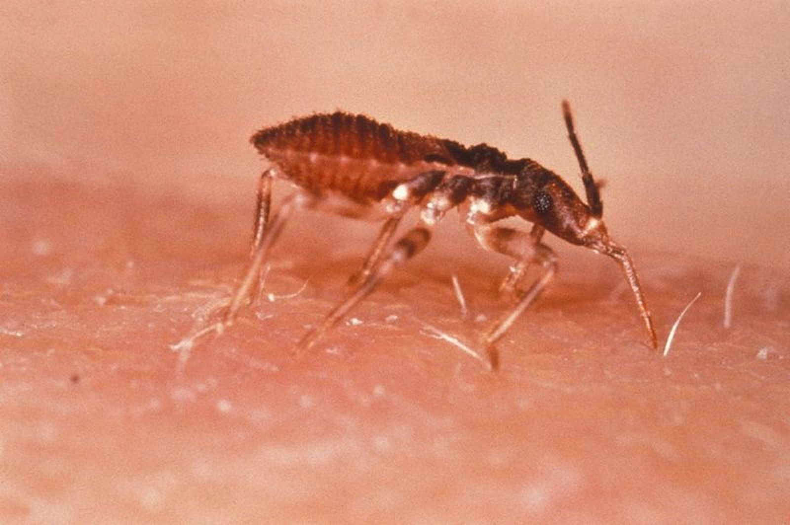 Archivo - Triatoma infestans (vinchuca), Chagas - CDC/WORLD HEALTH ORGANIZATION - Archivo