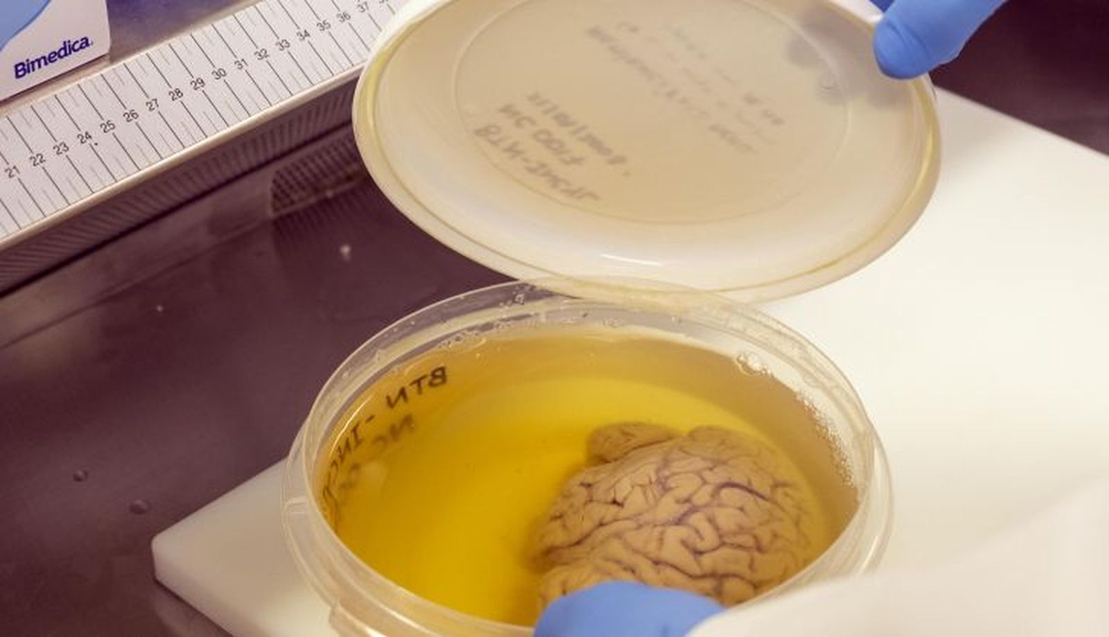 El banco de cerebros de Castilla y León está ubicado en el Incyl, en la universidad de Salamanca. Javier Herrero es el científico que lo dirige y se ocupa de su gestión. Foto ICAL (2)