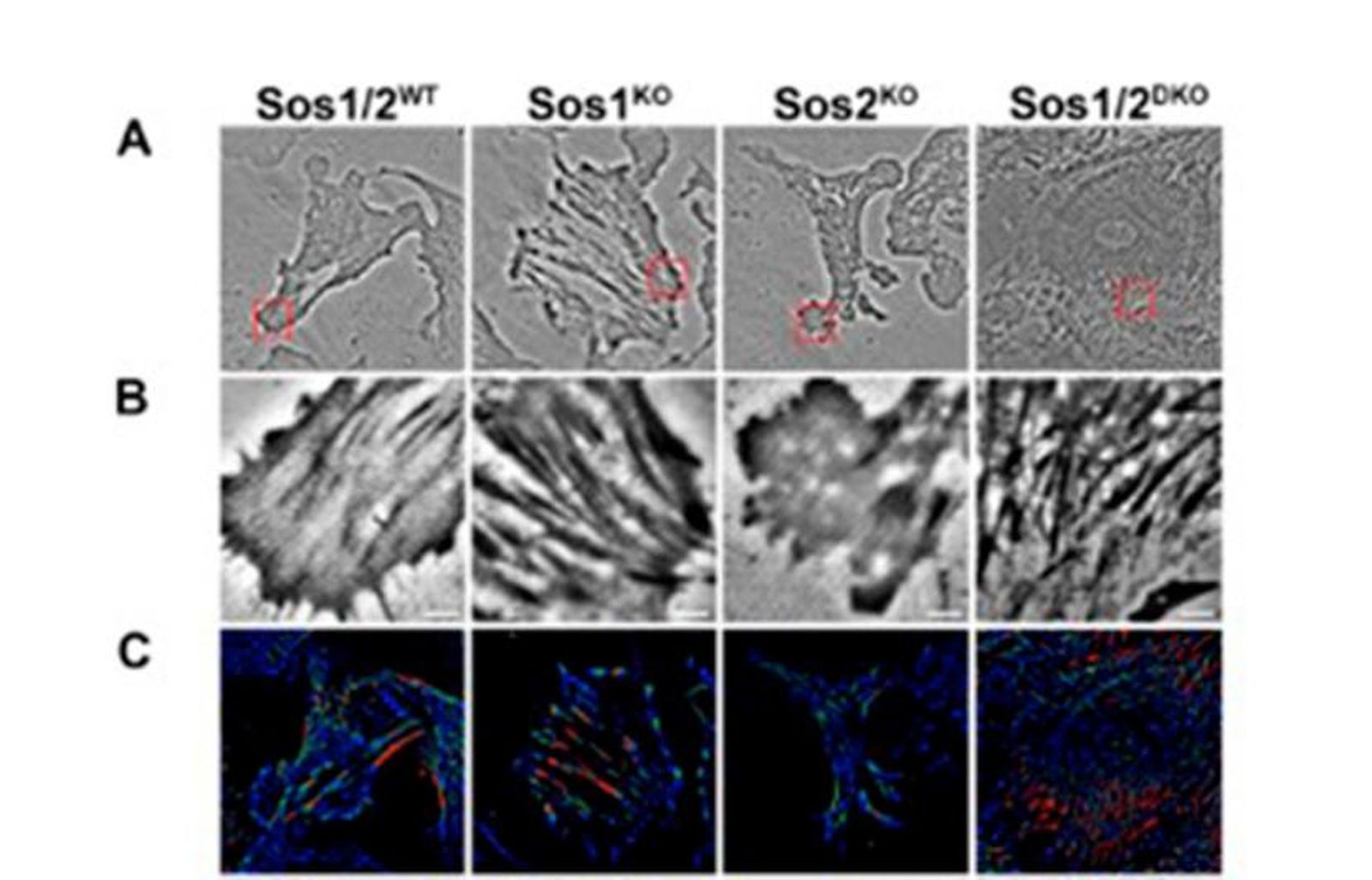 Descubrimiento sobre el Papel de las Proteínas Sos1 y Sos2 en la Migración Celular y la Degradación de la Matriz Extracelular