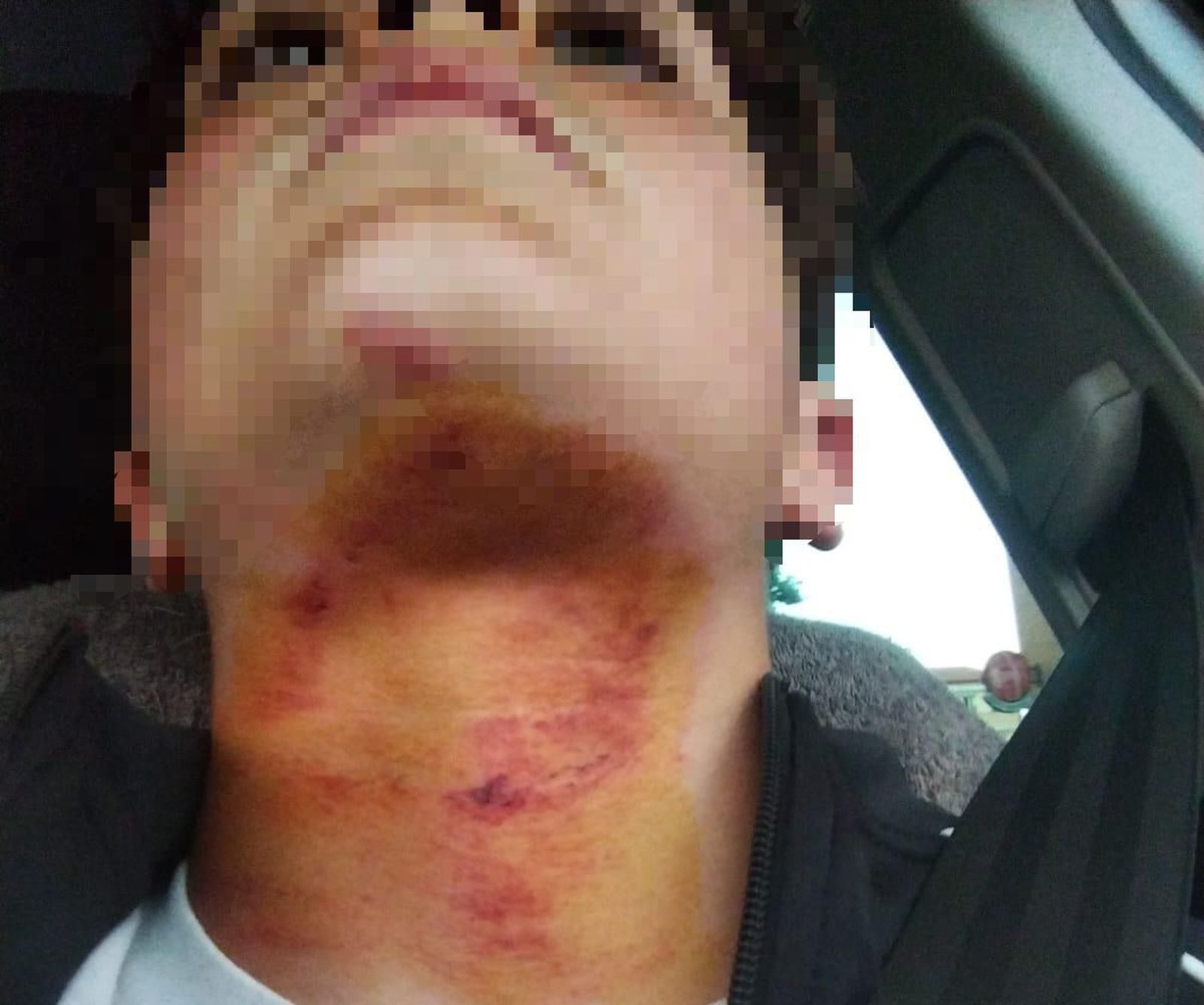 Estado en el que quedó el joven afectado