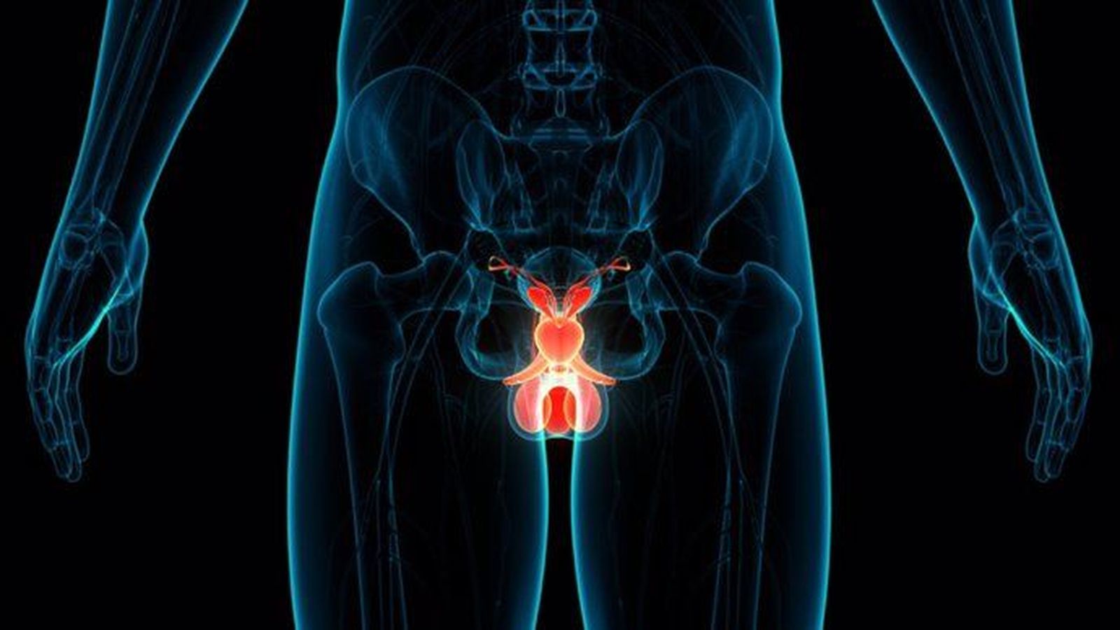 Cáncer de testículo. FOTO: Infosalus