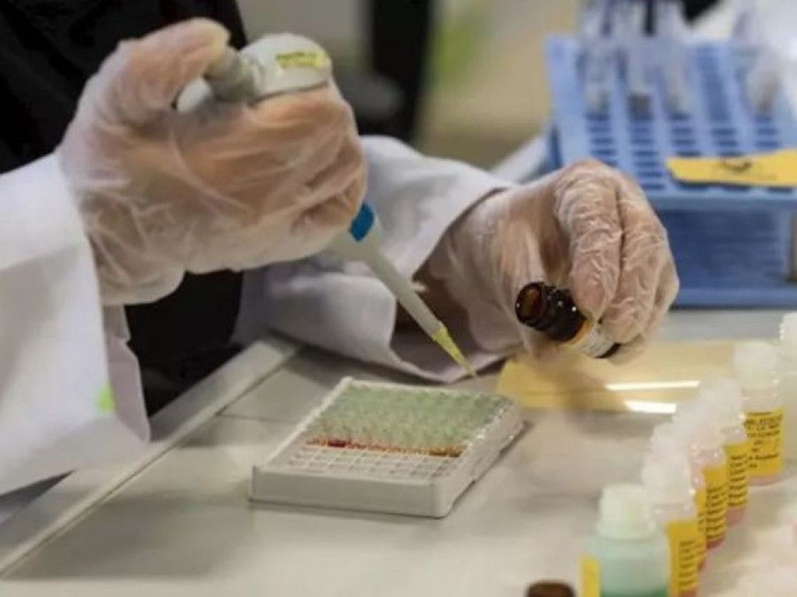 Coronavirus prueba test