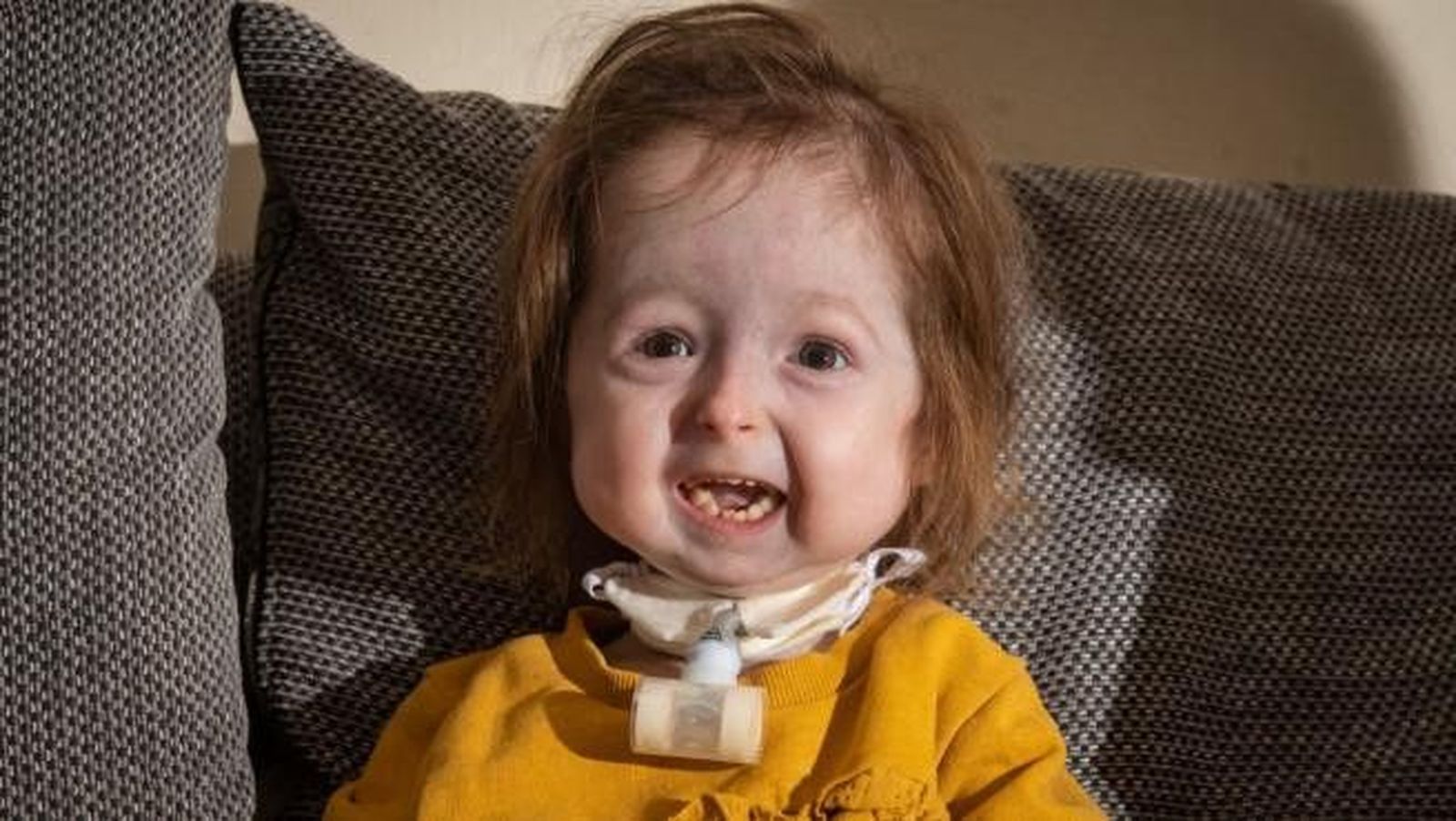 Isla kilpatrick screaton es la unica persona con una mutacion especifica de envejecimiento