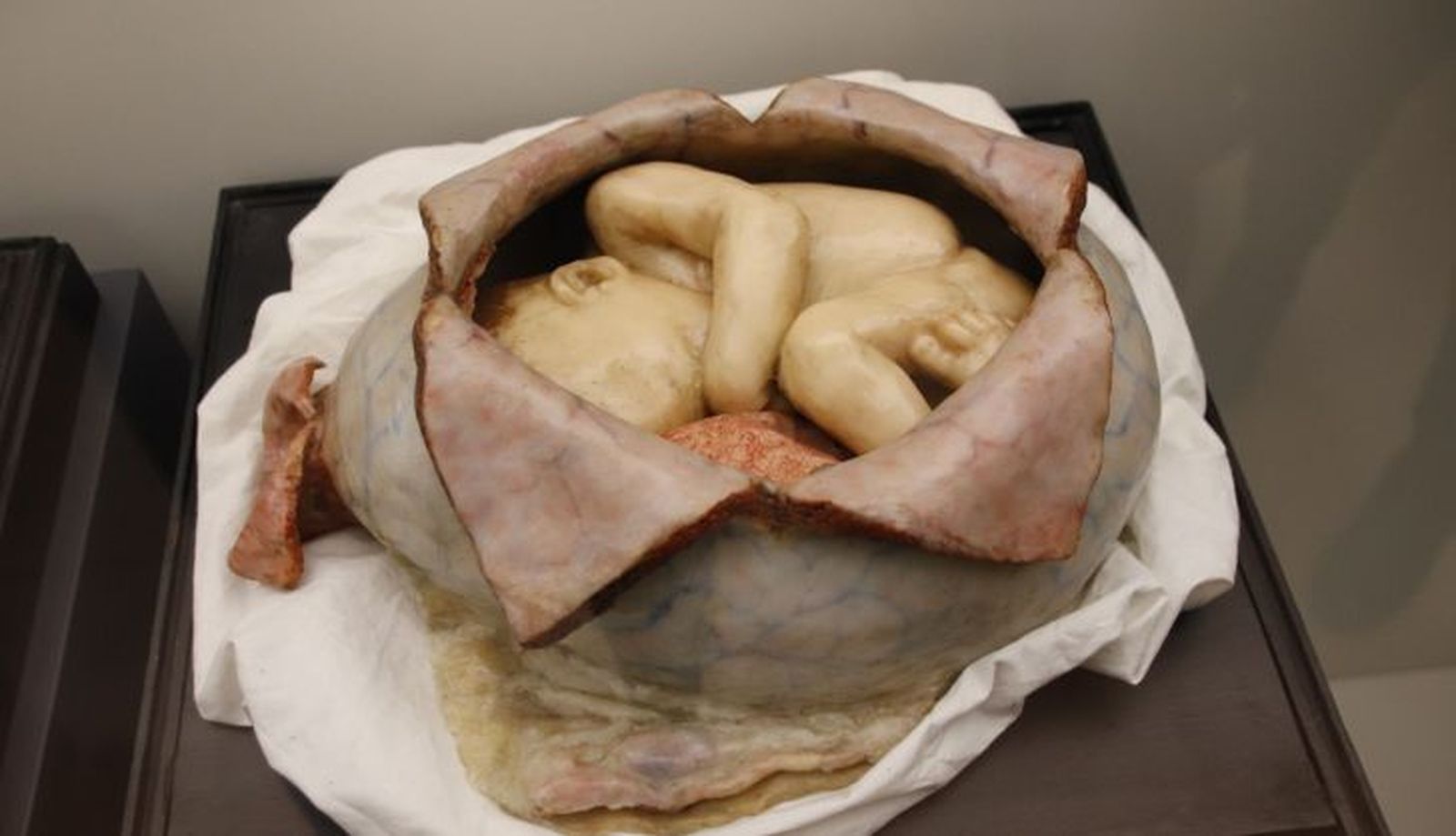 figuras anatómicas de cera coloreada de los siglos XIX y XX conservadas en el Departamento de Anatomía e Histologías Humanas de la Universidad de Salamanca