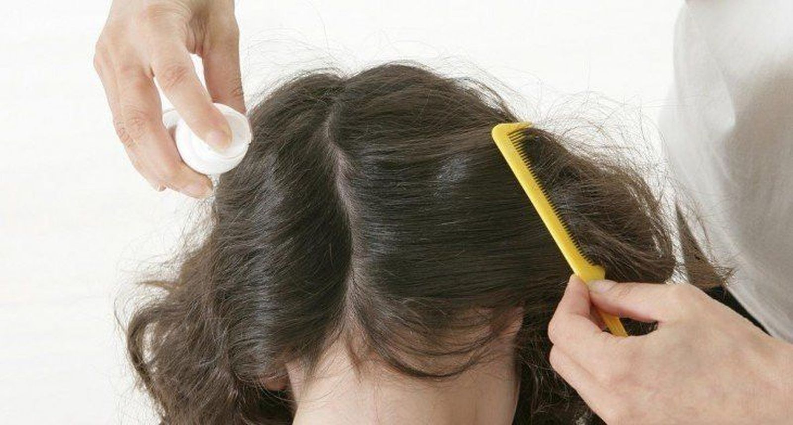 Piojos. Europa Press