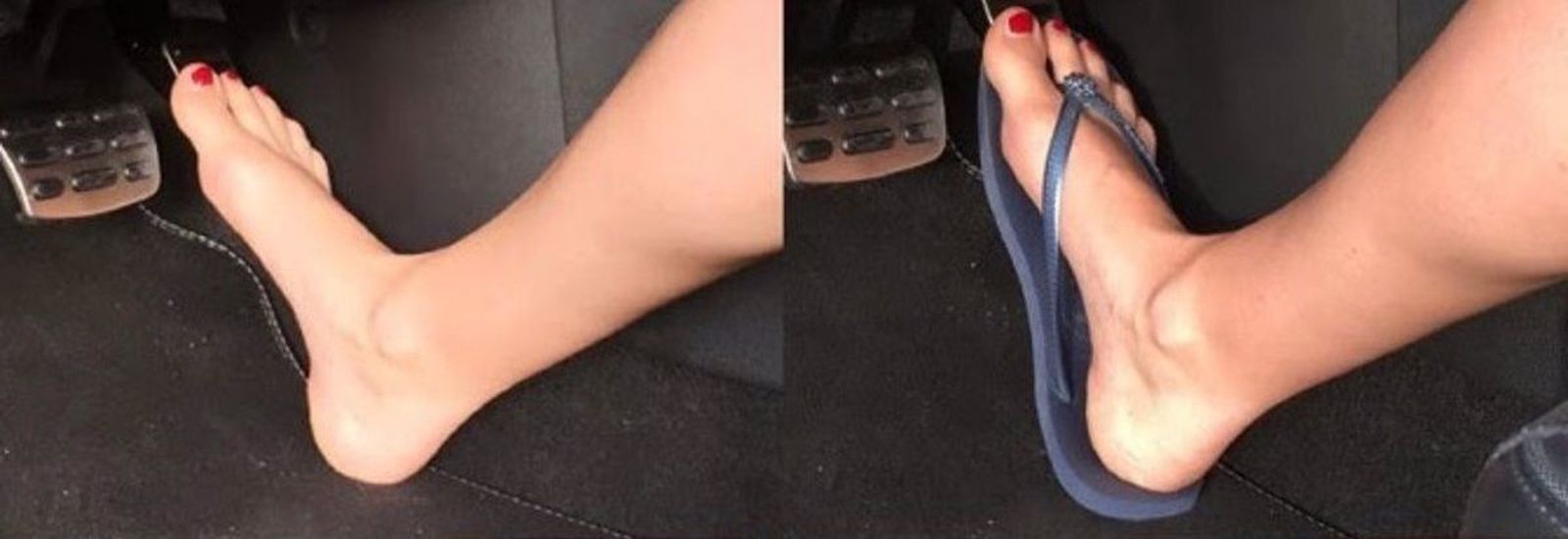 Conducir con chanclas. Foto EP