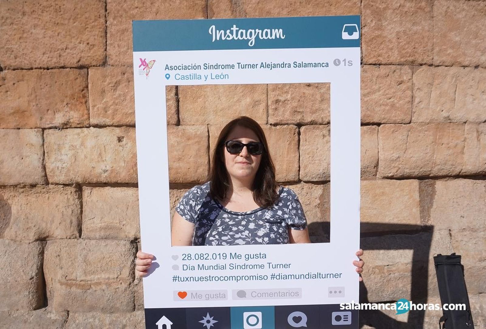 Viriginia . síndrome de turner