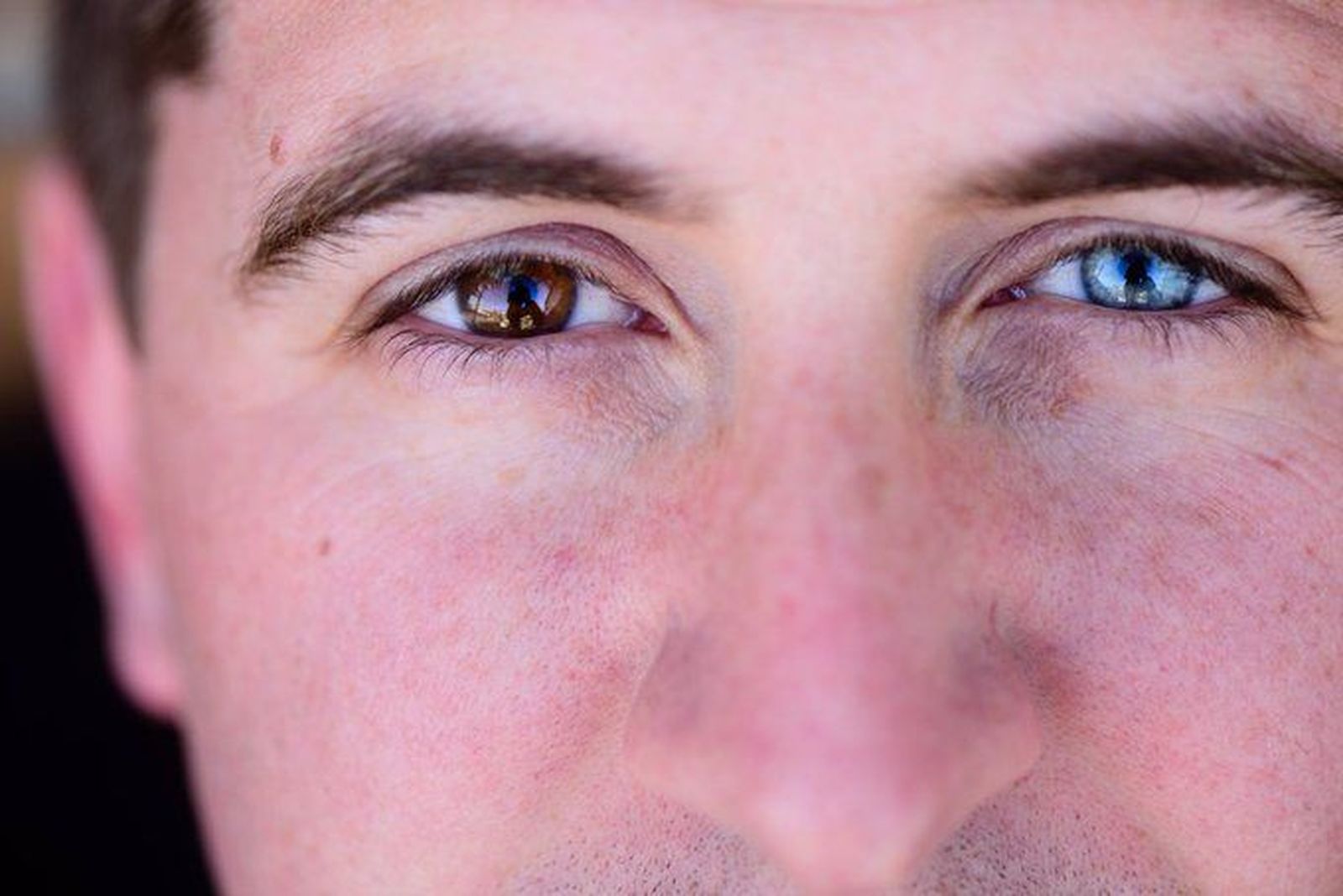 Heterocromía, cuando cada ojo es de un color | Foto Infosalud EP