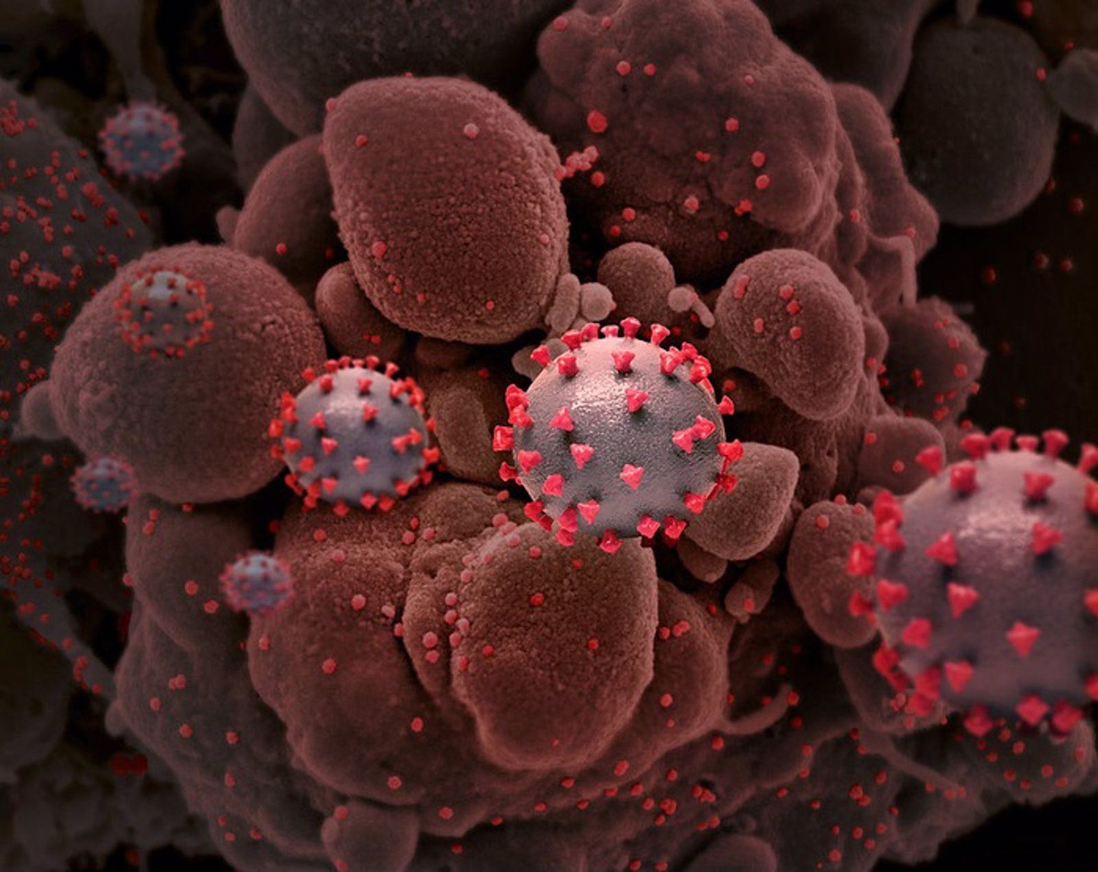 Representación creativa de las partículas del virus del SARS-CoV-2, causante de la COVID-19.