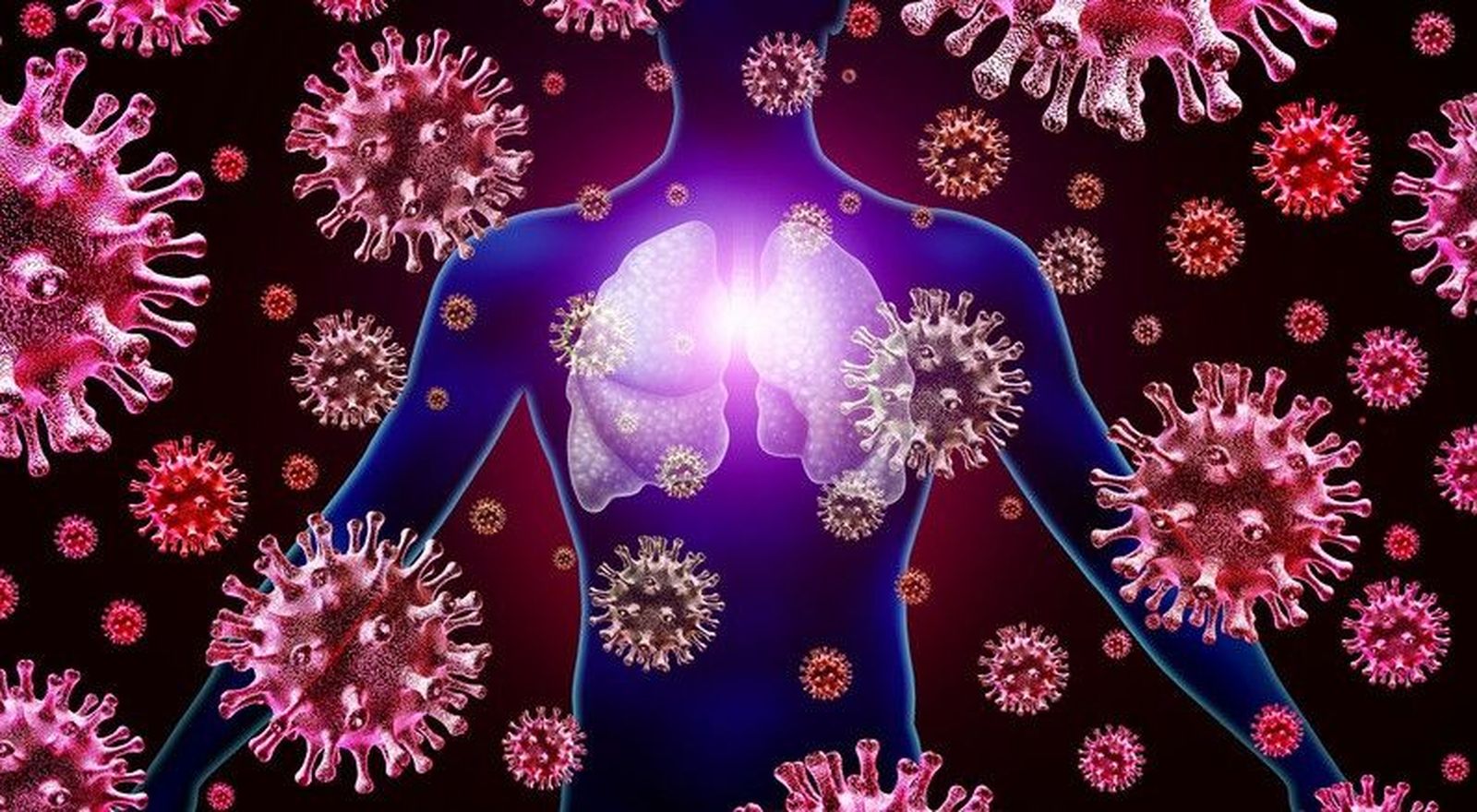 Infección pulmonar  Infección pulmonar por virus respiratorios y brote de gripe y coronavirus o coronavirus como casos peligrosos de SARS como un concepto médico pandémico o epidémico con element