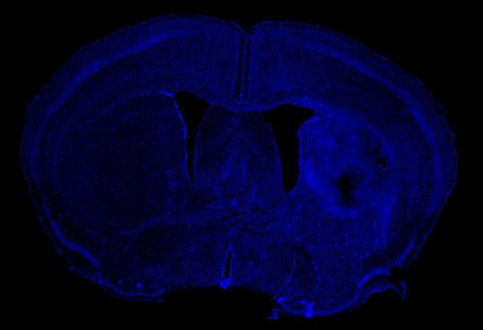 2. Hemorragia corte completo DAPI