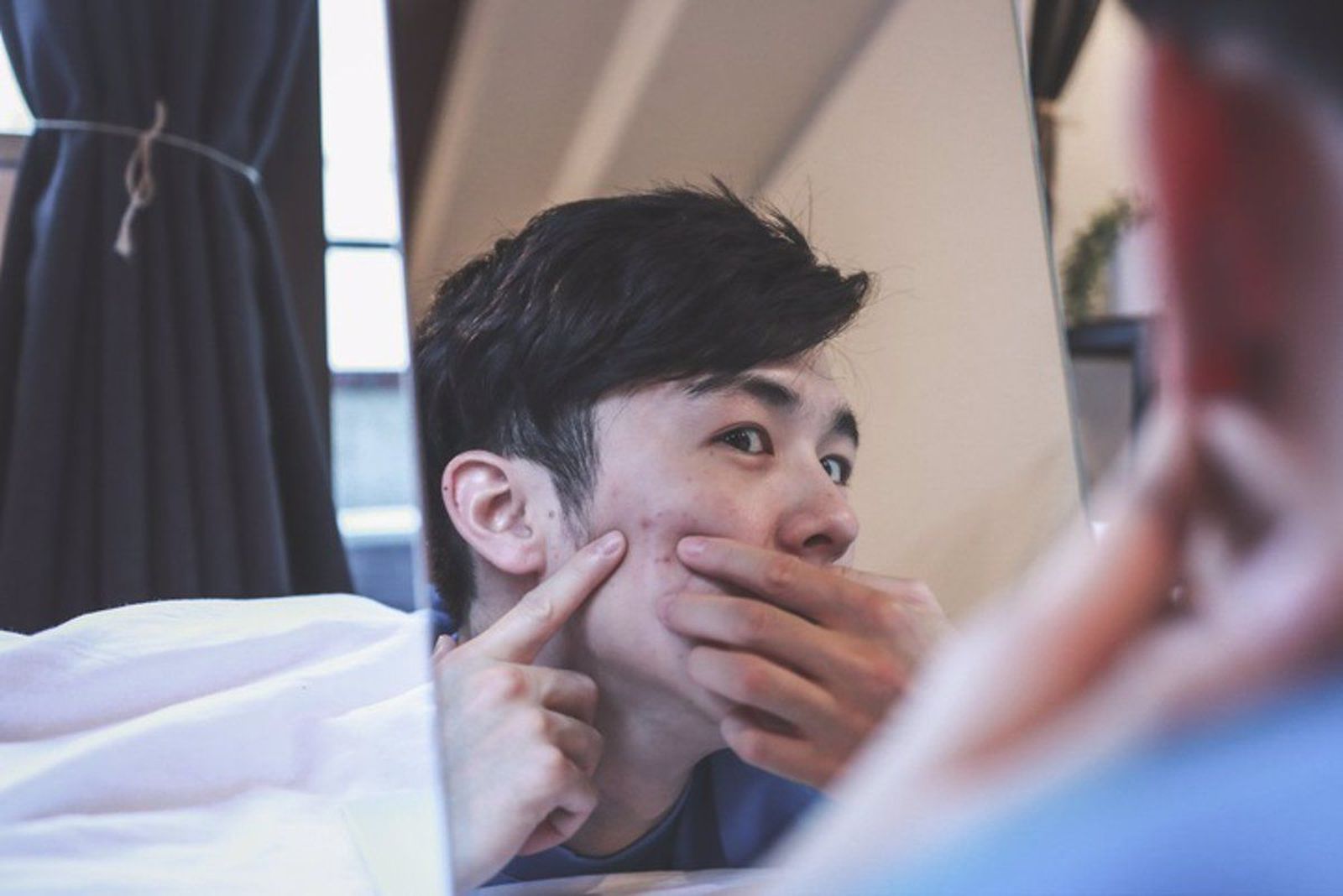 Hombre quitándose granos o espinillas. Europa Press