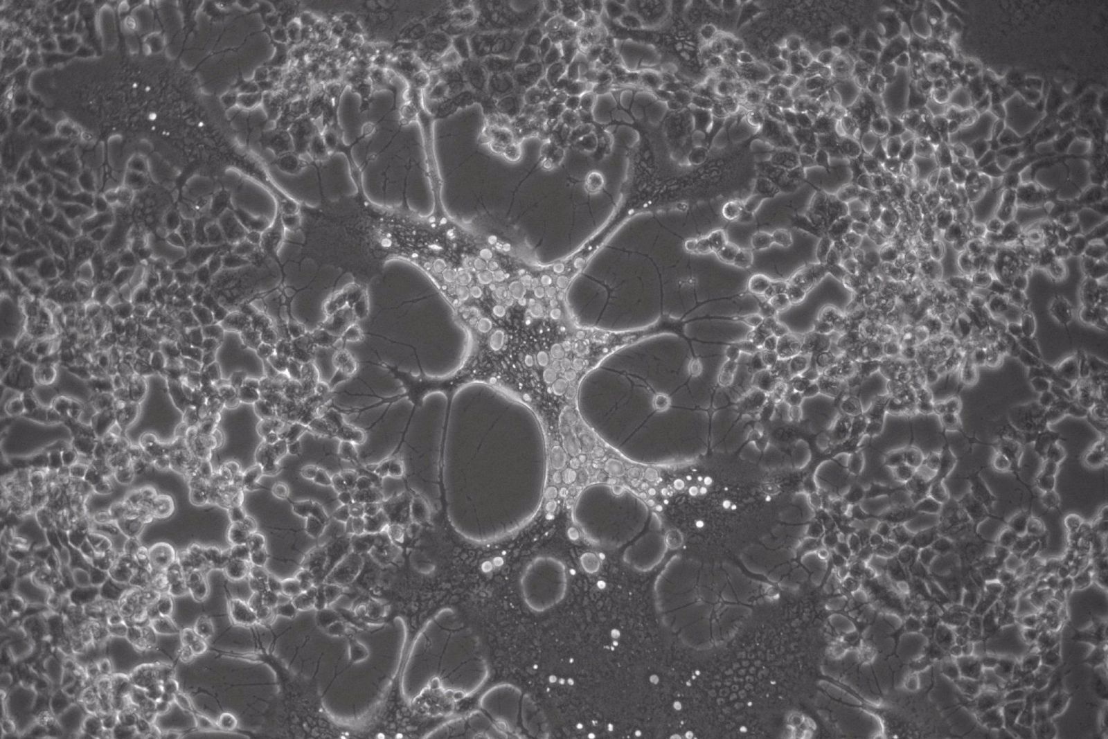 Célula infectada con una variante del Virus del Herpes Simplex generada durante el cultivo celular. Foto EP. Célula infectada con una variante del Virus del Herpes Simplex generada durante el cultivo celular. Foto EP.