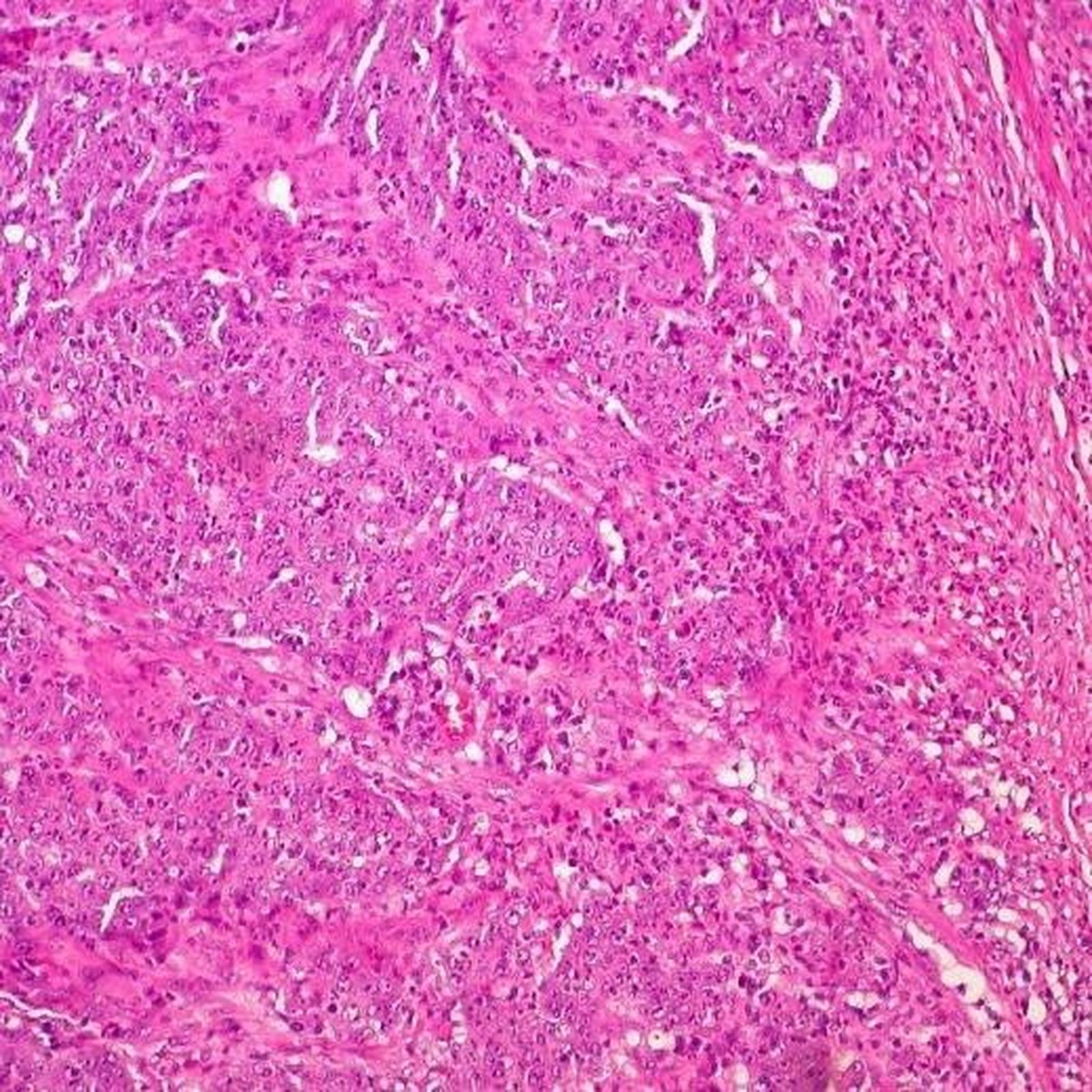 Fotonoticia 20190910122251 1920