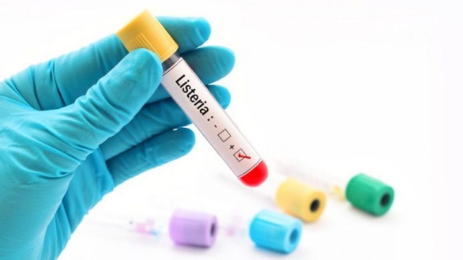 Listeria positive picture id929503284 0