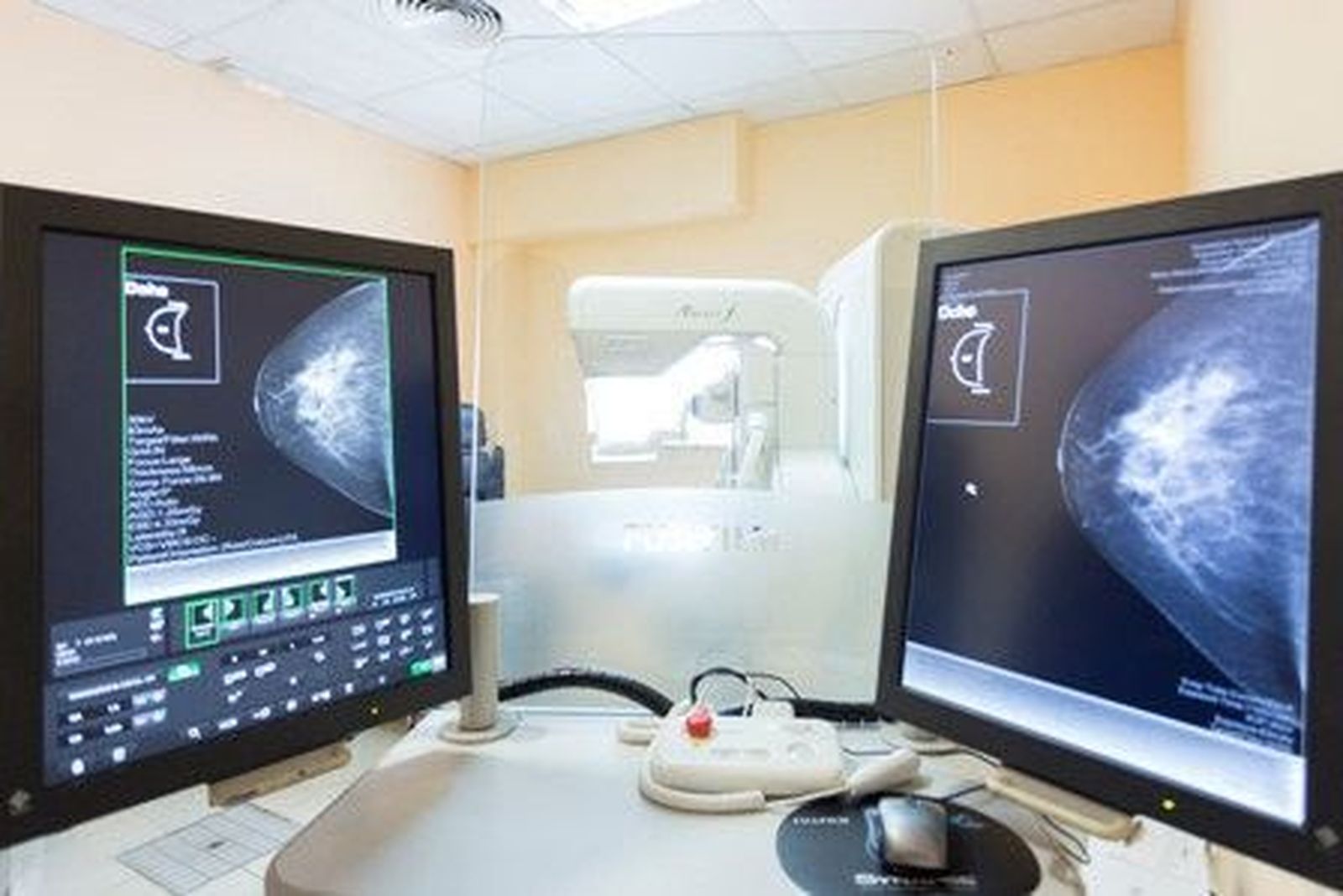 El Hospital de Salamanca contará con un nuevo mamógrafo digital