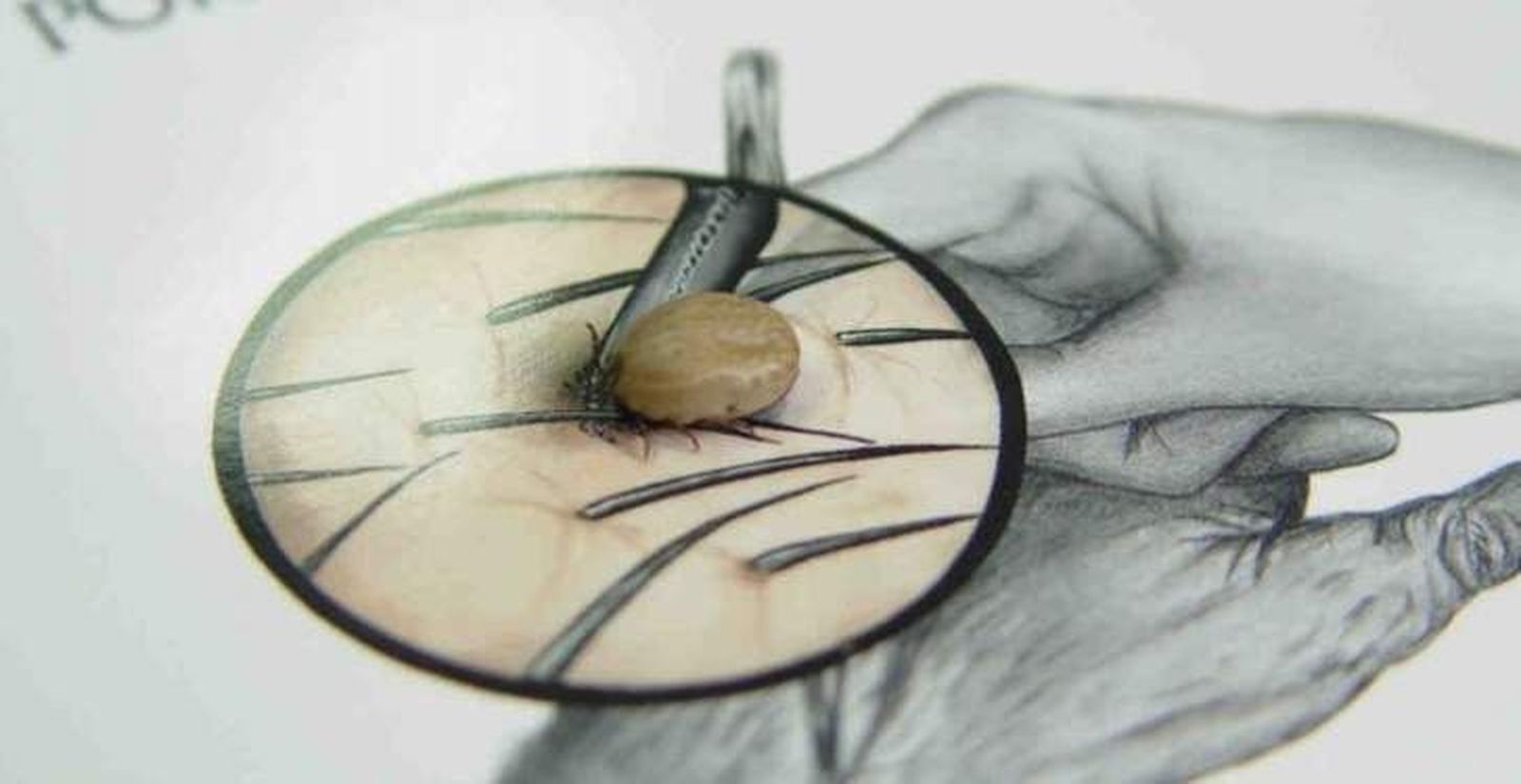 Sanidad recuerda que el riesgo de contagio por fiebre hemorrágica de Crimea-Congo es muy bajo